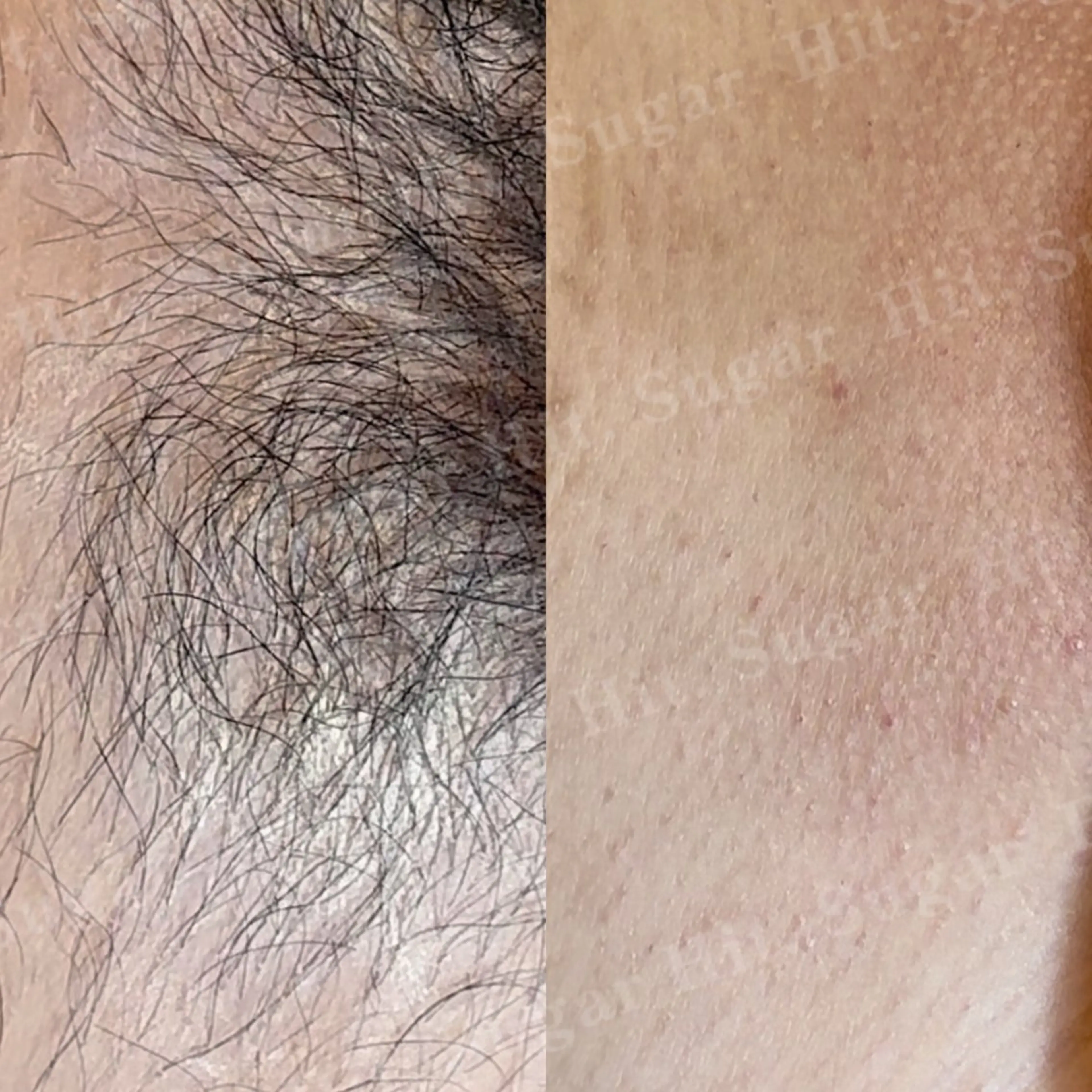 Hitomi シュガーリング豊橋のその他イメージ