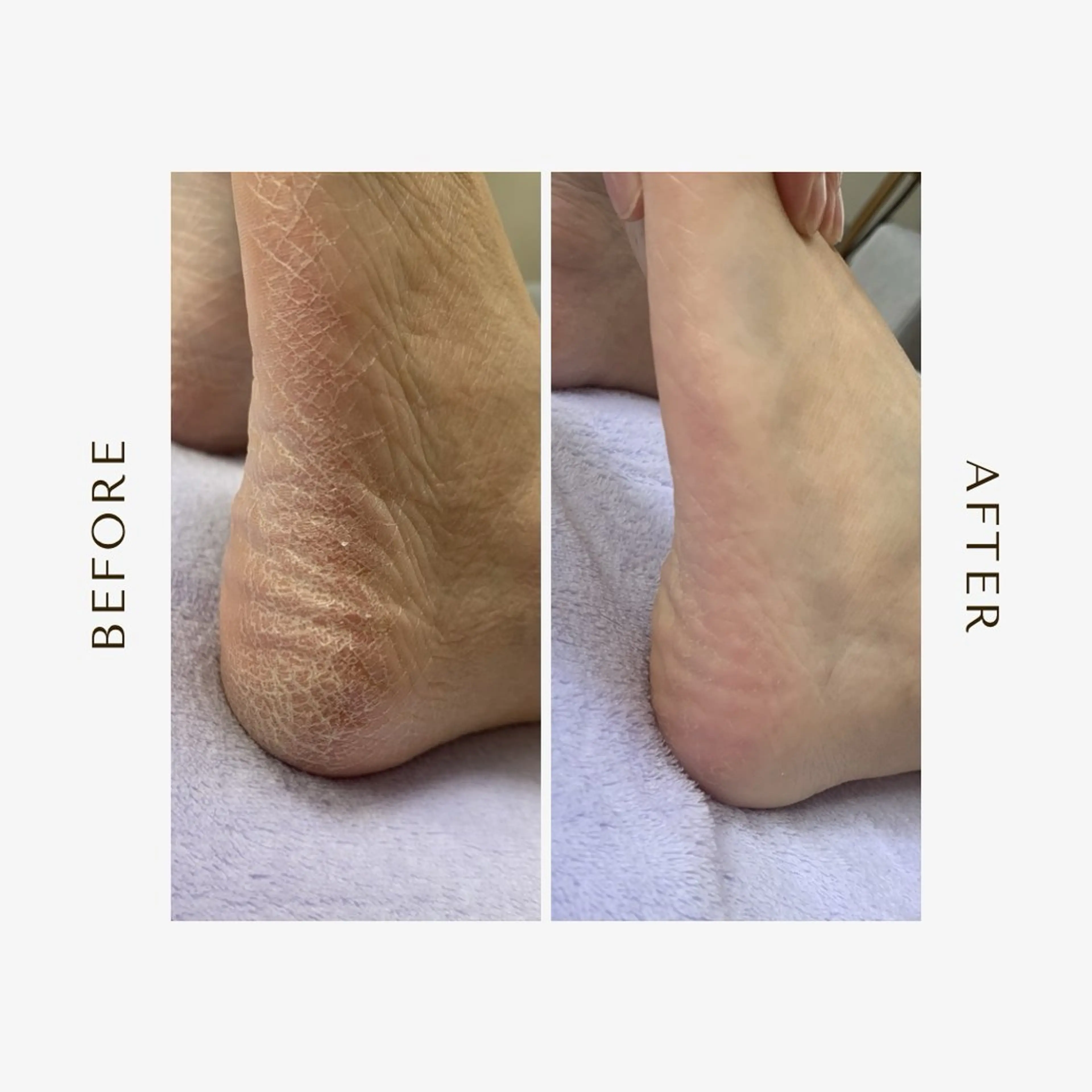 足トラブル専門 ニコルル金沢のエステ・リラクイメージ