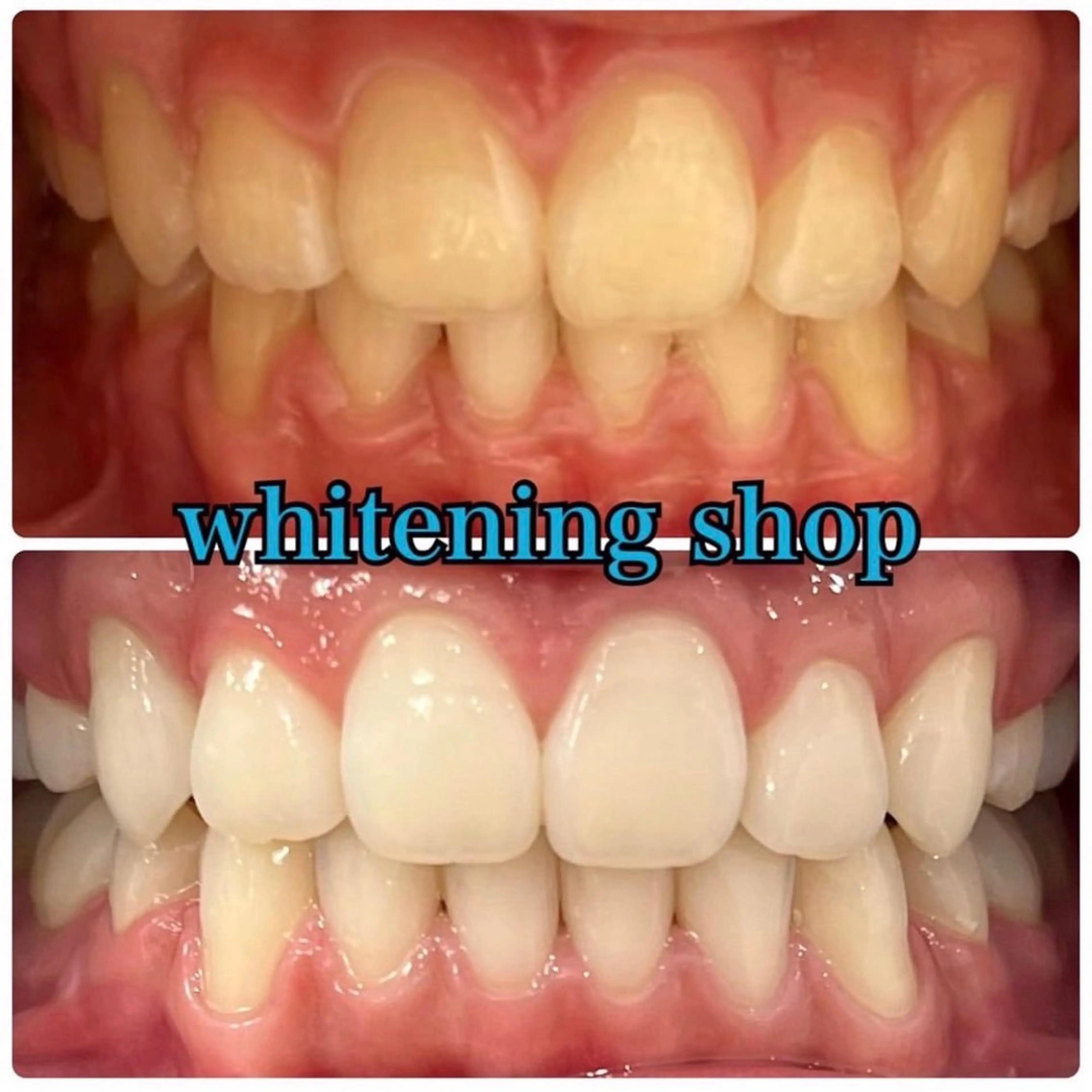 エステ リラク ホワイトニング ショップ吉祥寺店のエステ・リラクイメージ