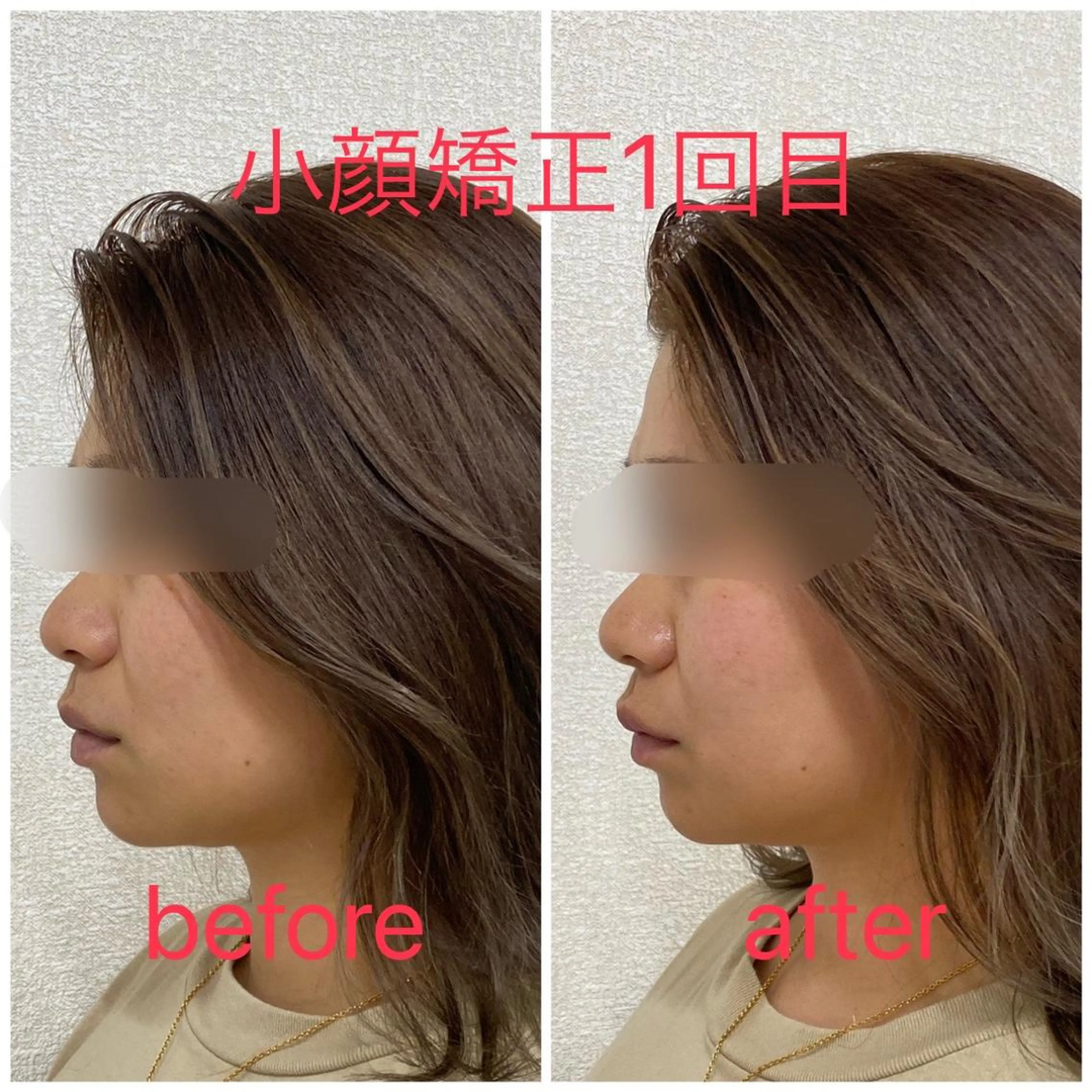 小顔矯正サロン Lilyのエステ・リラクイメージ
