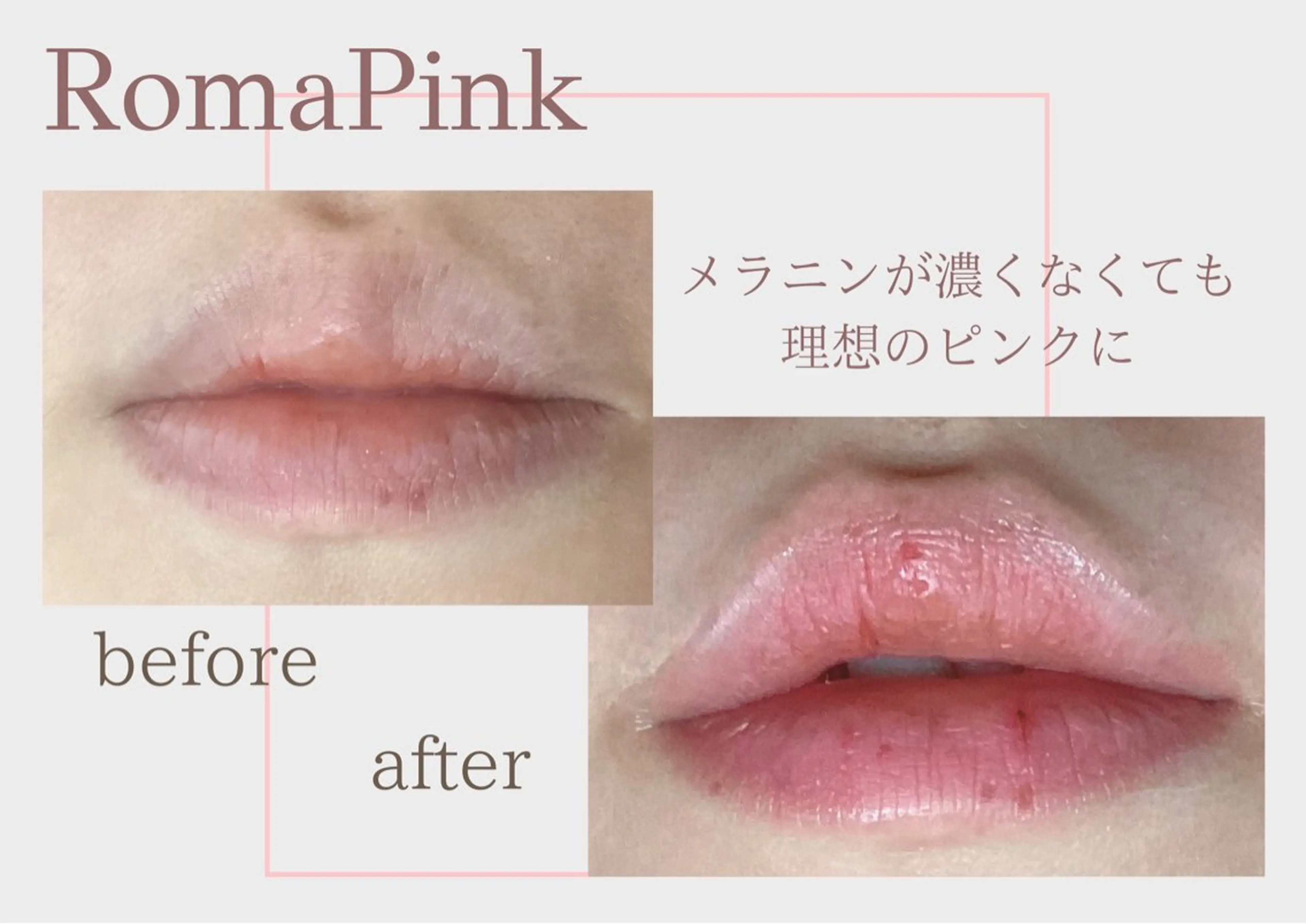 その他 看護師 AYUIのエステ・リラクイメージ