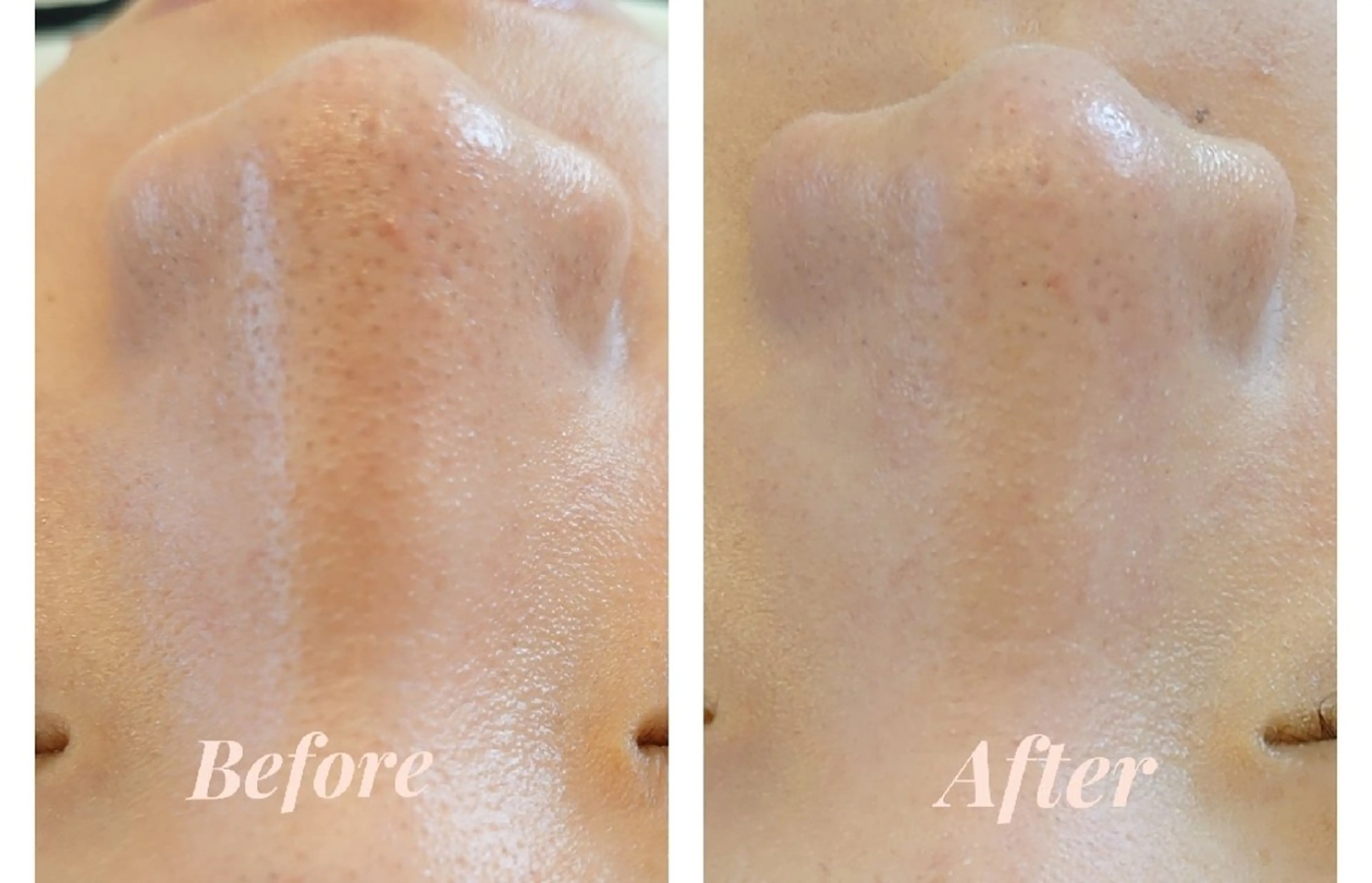 M✨ Hoshi💎✨のエステ・リラクイメージ