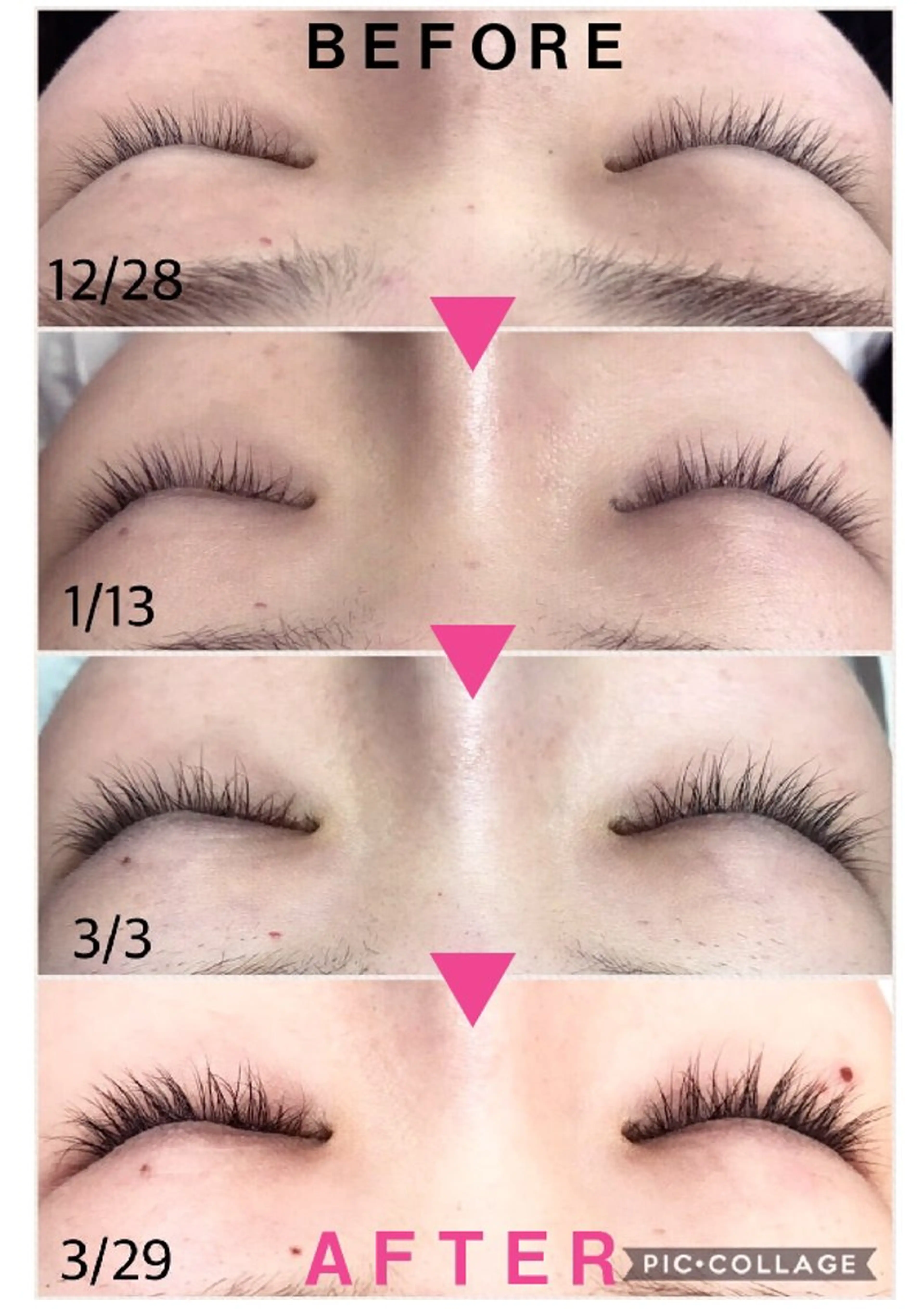 ✨まつ毛の育毛スキンケア✨ラッシュアディクトサロンケアの写真