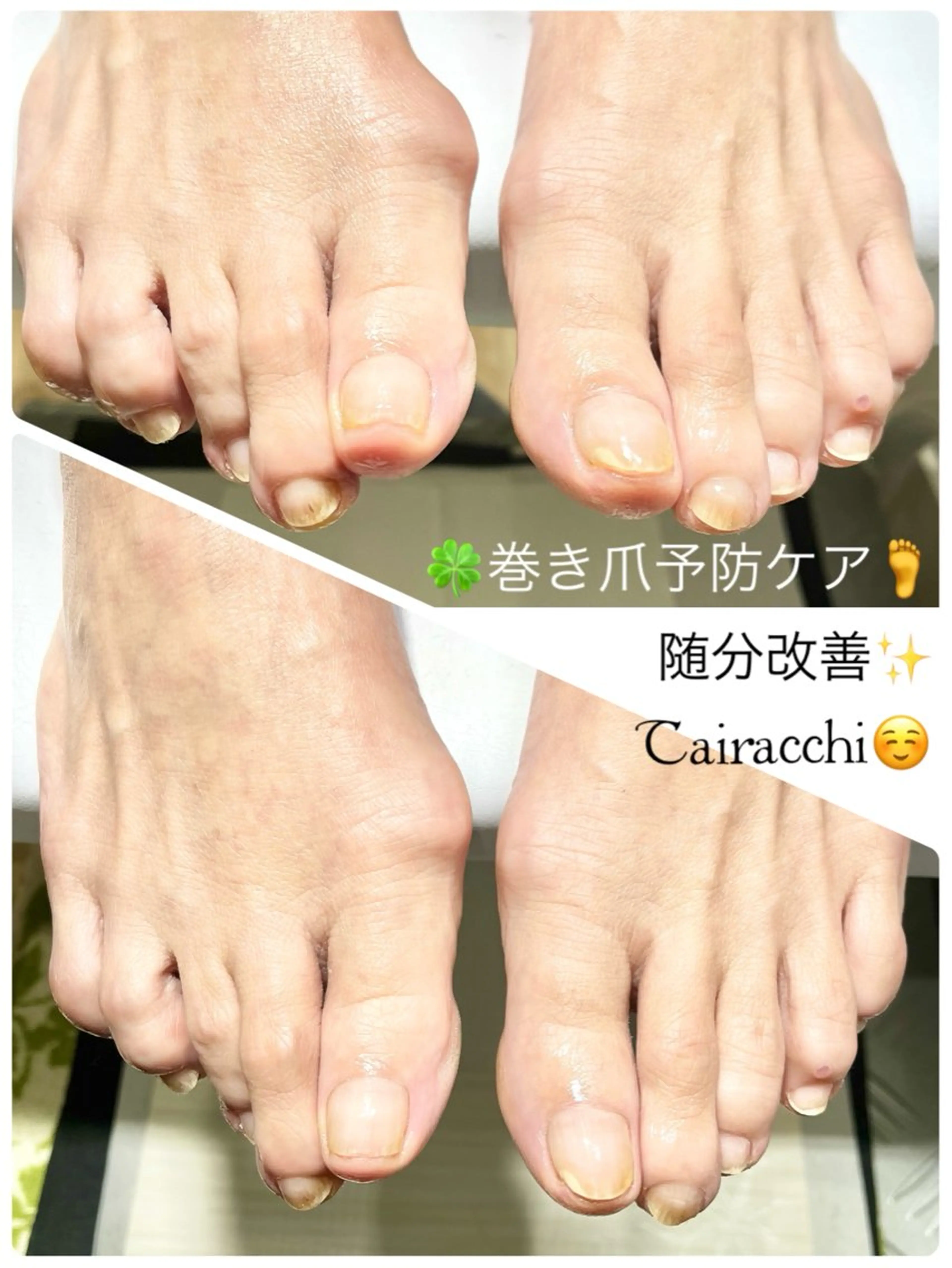 ネイル フットネイル フットネイル Tairacchi タイラッチのネイルデザイン