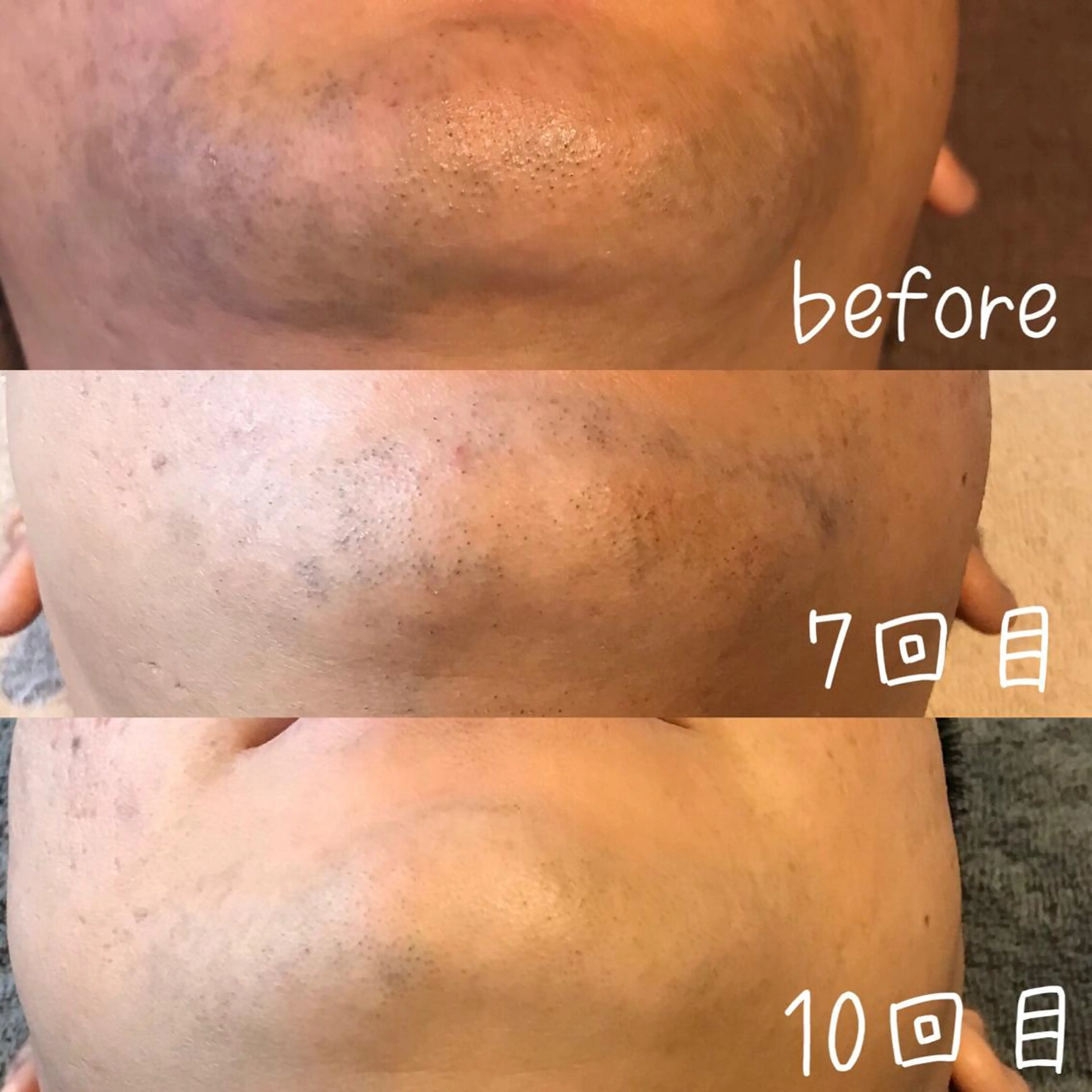 脱毛 浜野 恵美のエステ・リラクイメージ