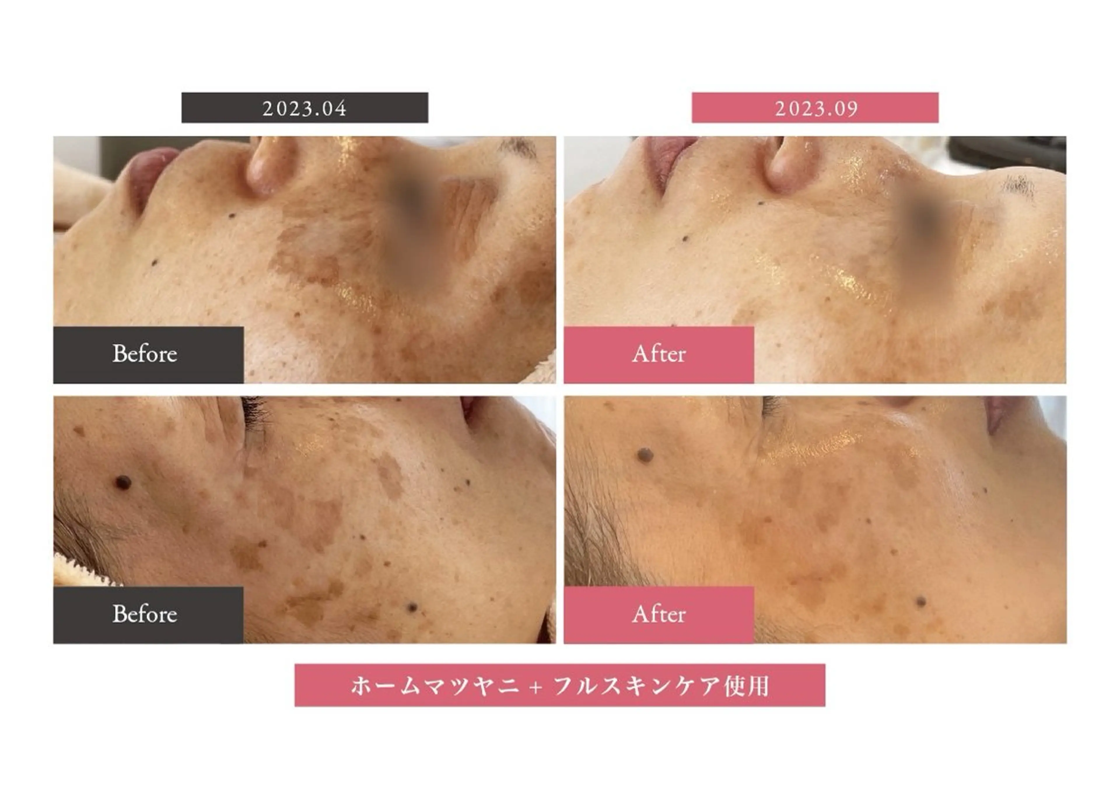 ヌーベル プリュムのその他イメージ