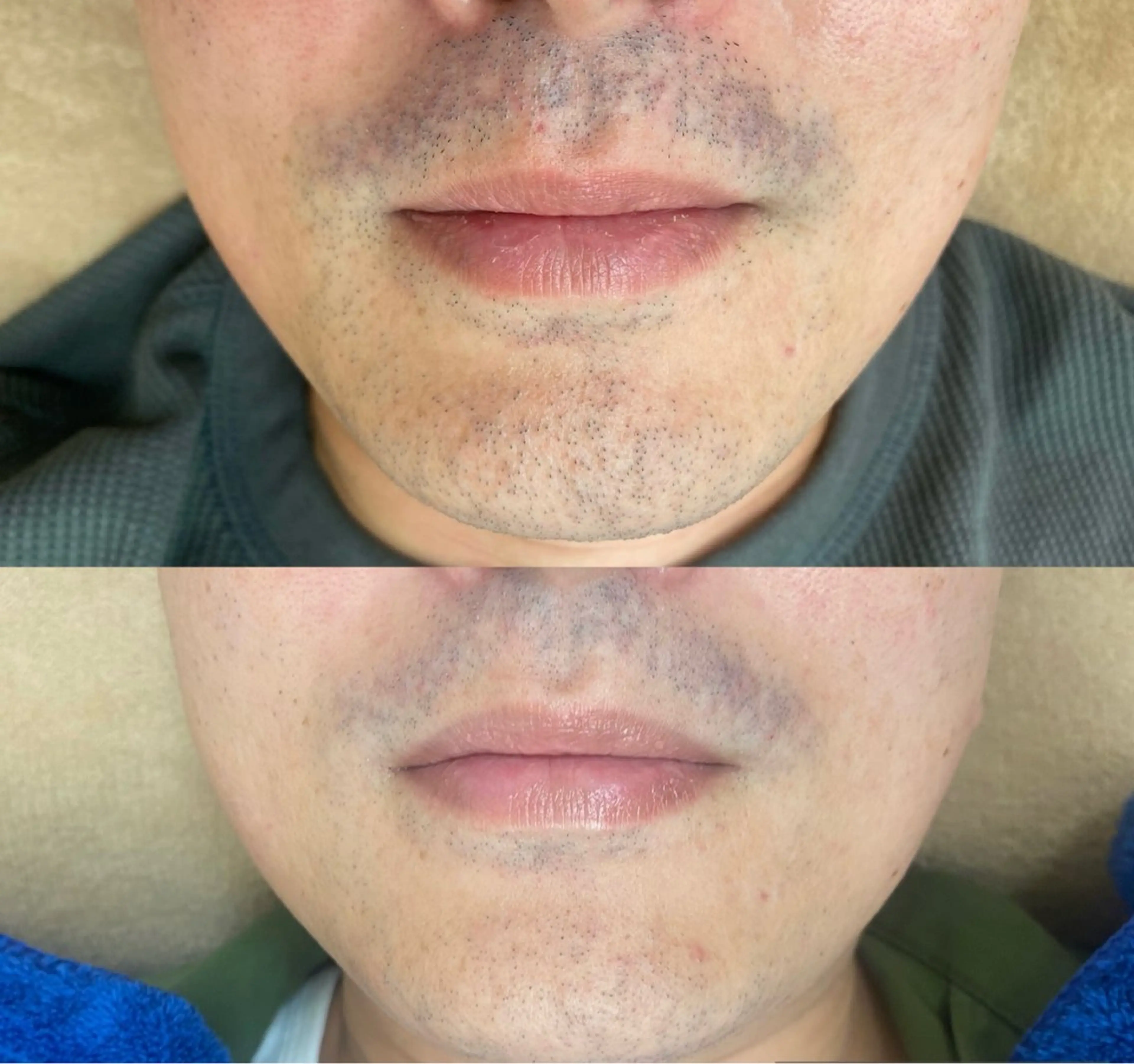 メンズ 脱毛 RE:moom リムーム/脱毛エステのエステ・リラクイメージ