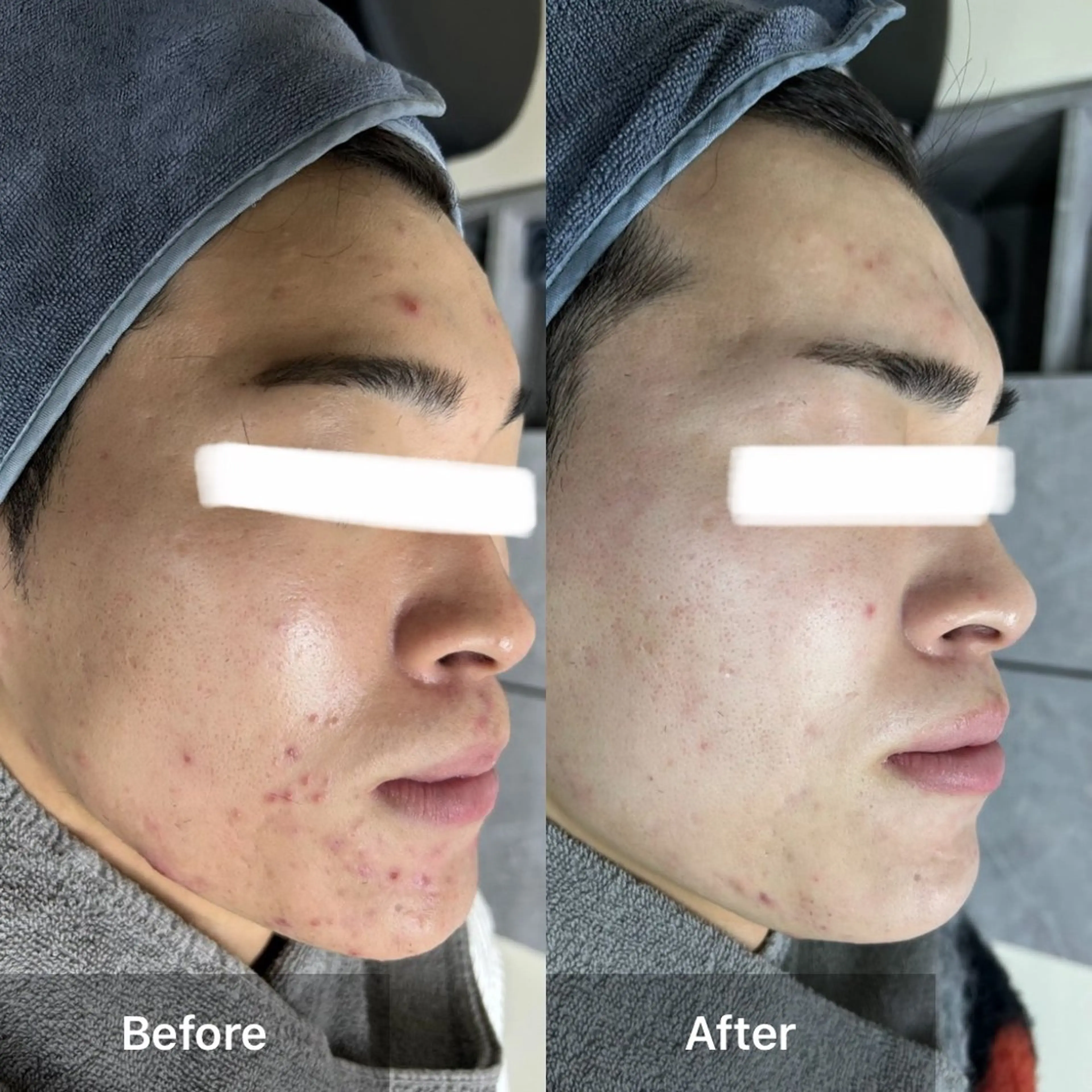 エステ ハーブピーリング 専門店MOKA所属・ハーブピーリング専門 MOKAのエステ・リラクイメージ