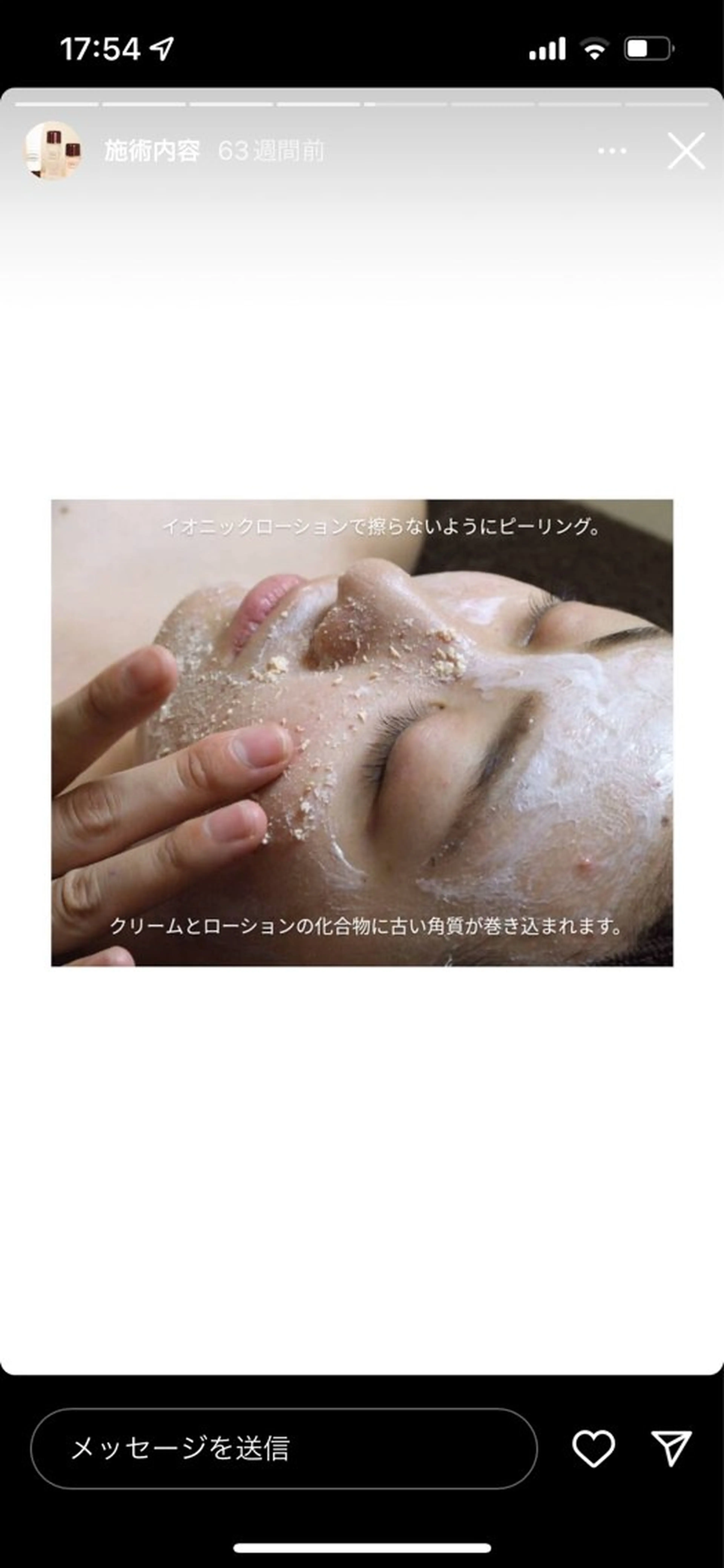 ニキビ跡改善専門🔥 医療にはできない改善のエステ・リラクイメージ