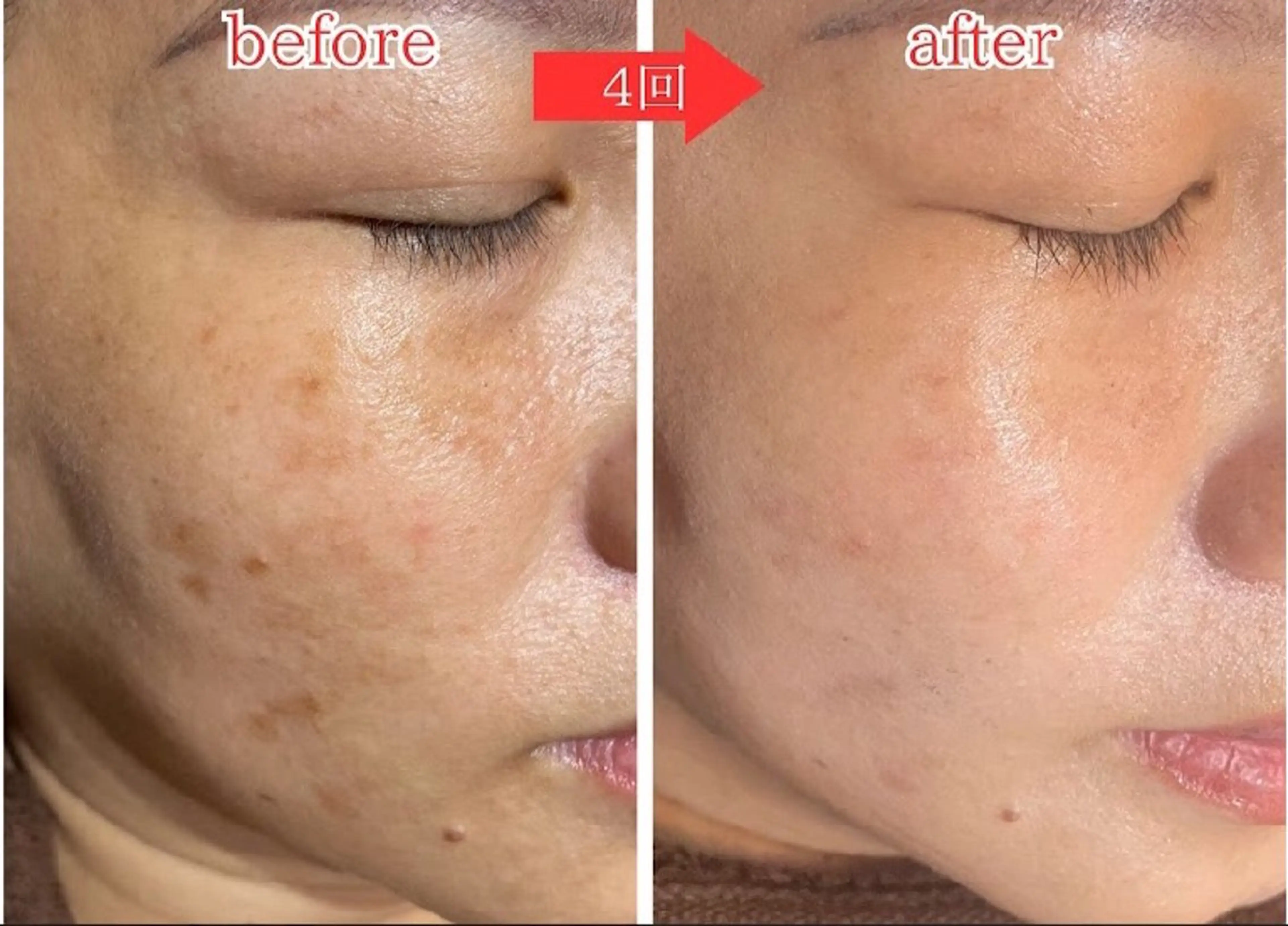 エステ 肌管理&nail Salon  Duxのエステ・リラクイメージ