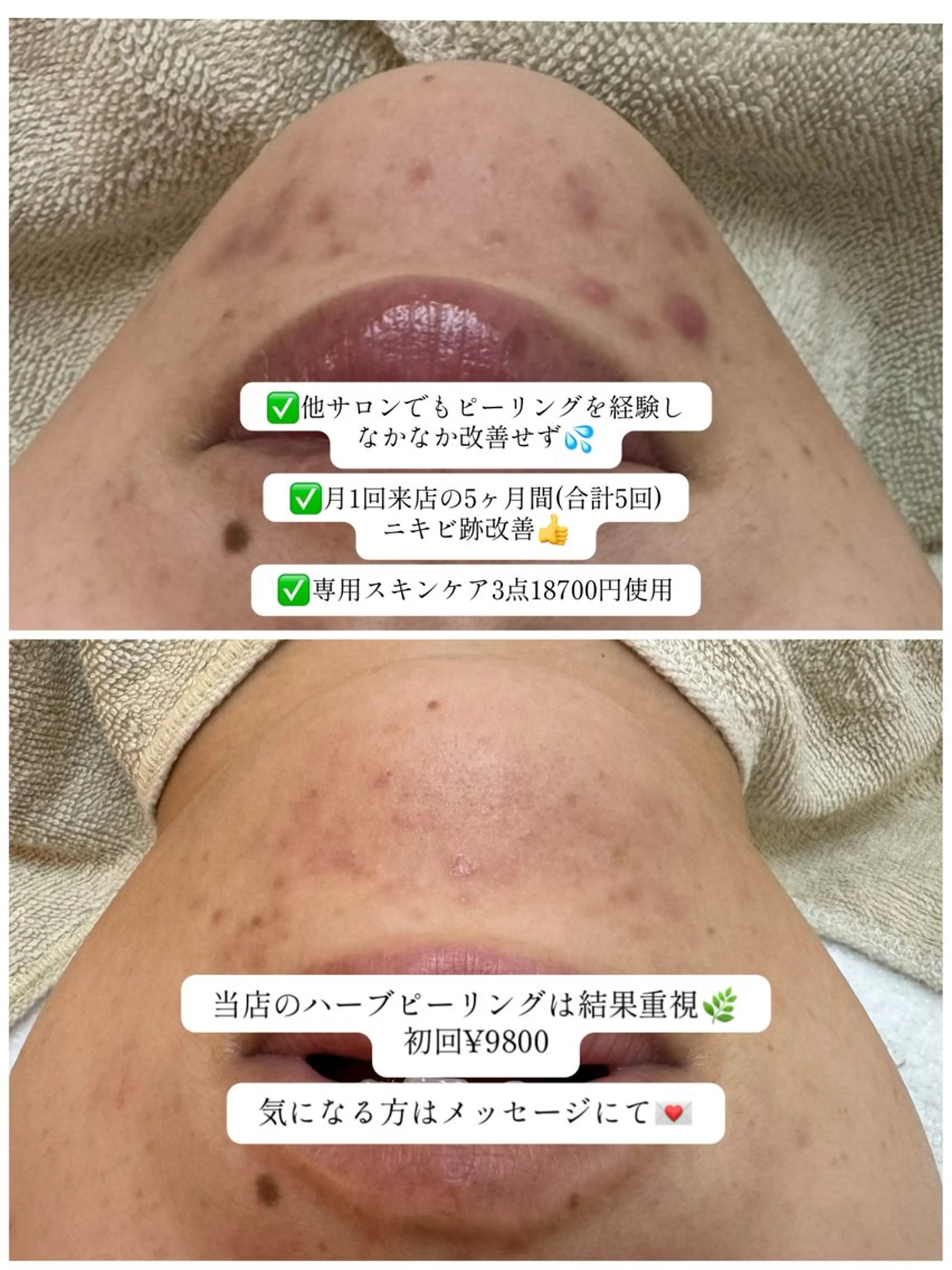 エステ リラク シミ毛穴専門店 yucca(ユッカ)のエステ・リラクイメージ