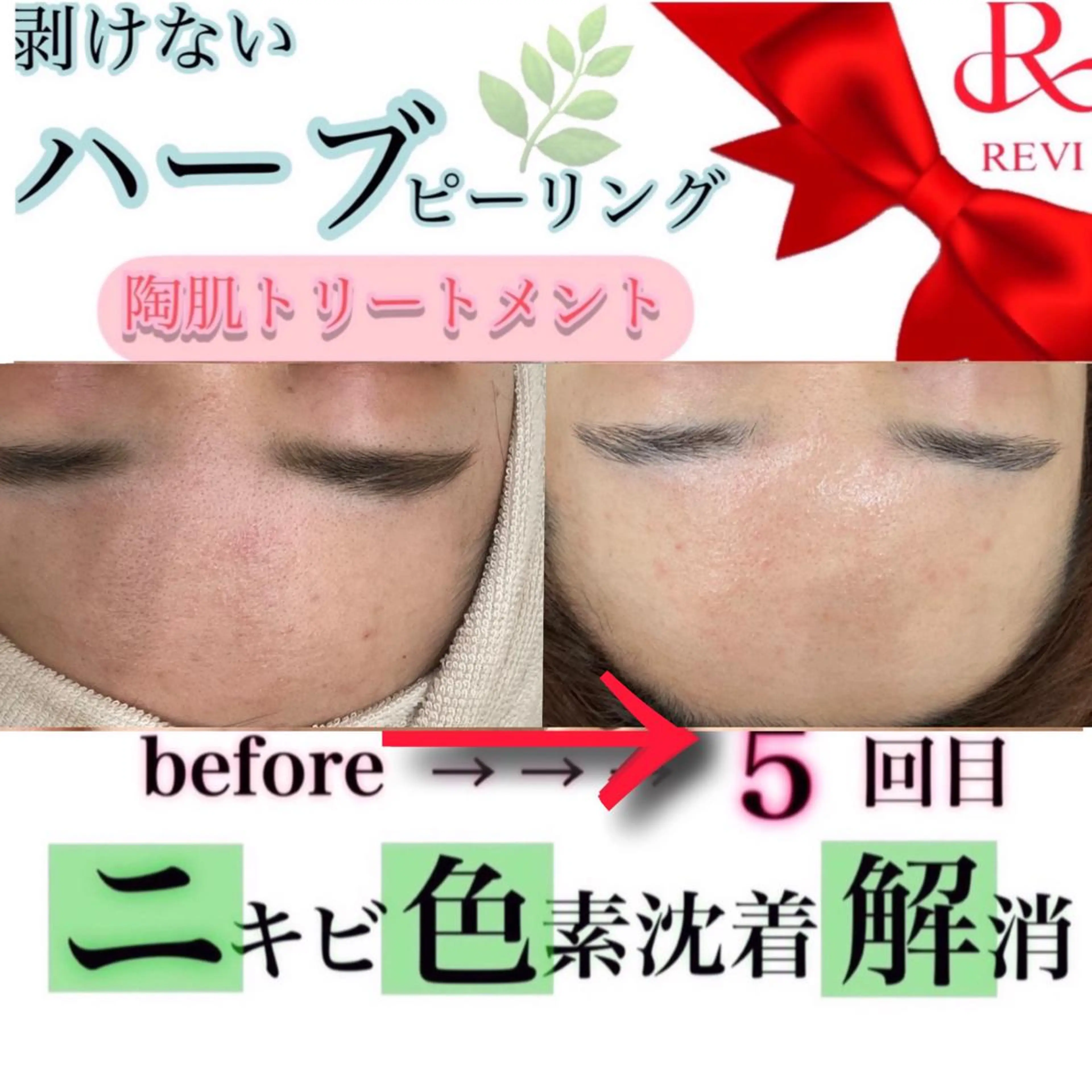 laluna saki...のその他イメージ