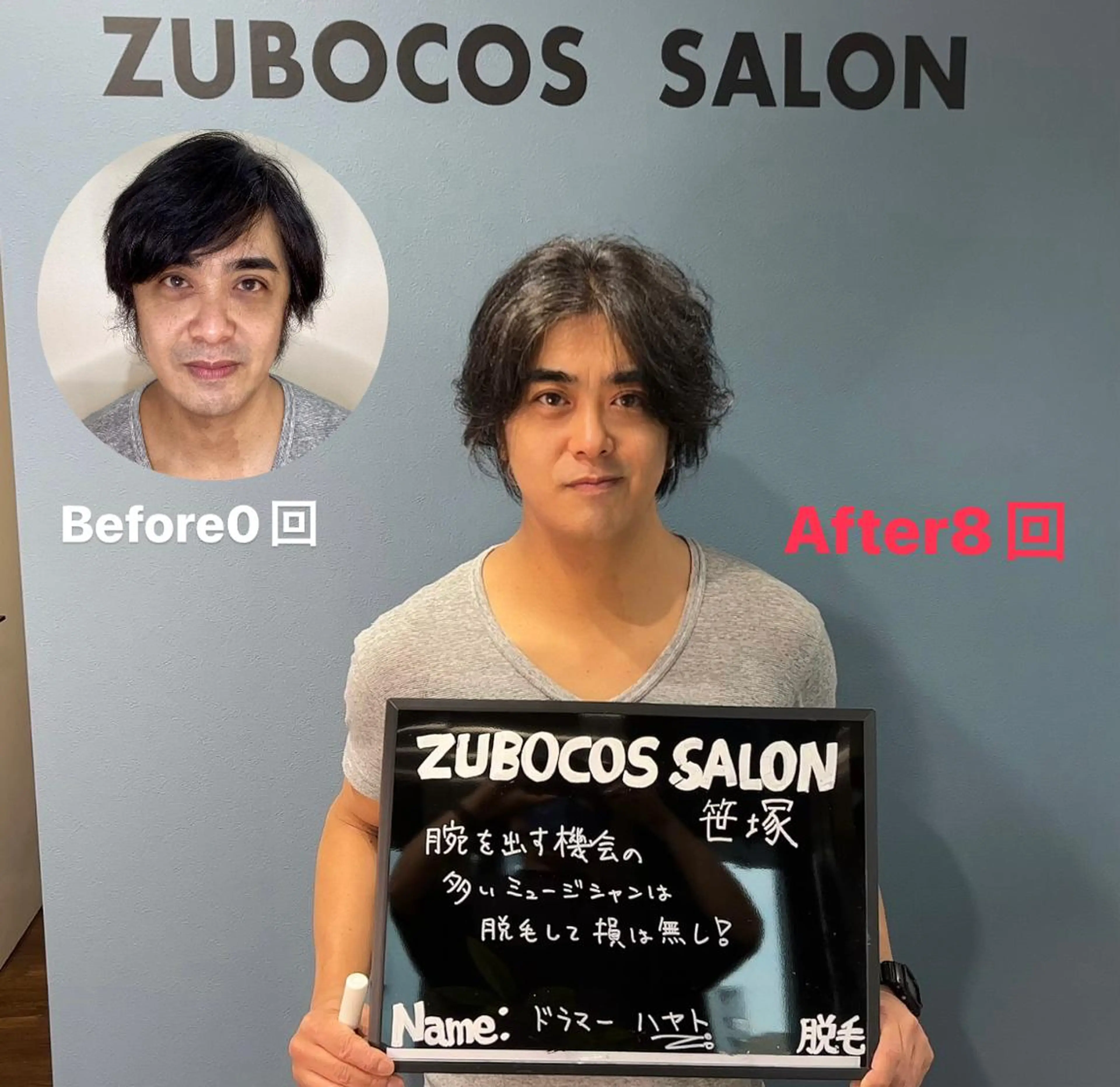 メンズ 脱毛 パーソナルセルフ脱毛 ズボコスサロンのエステ・リラクイメージ