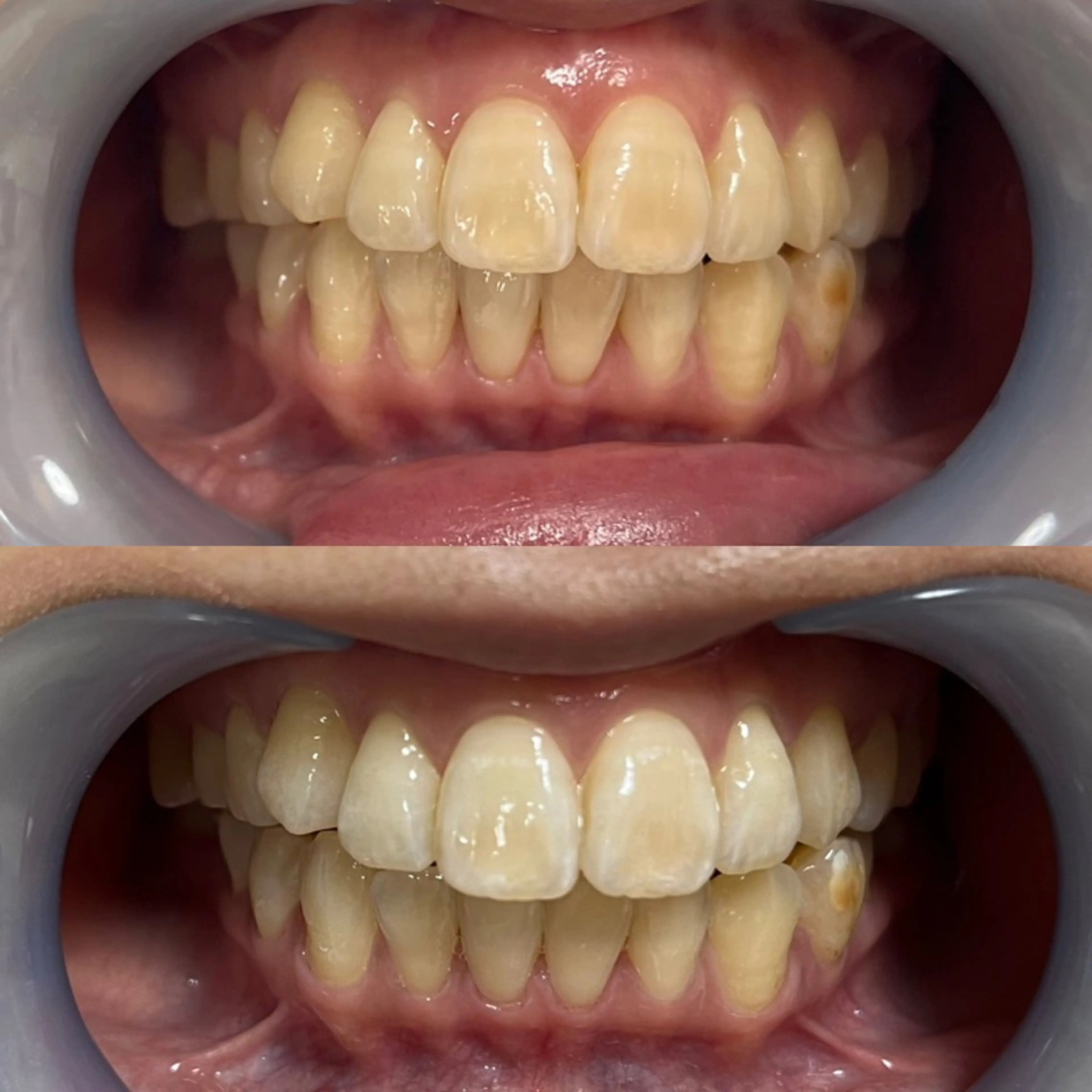 その他 Lyf salon.のエステ・リラクイメージ