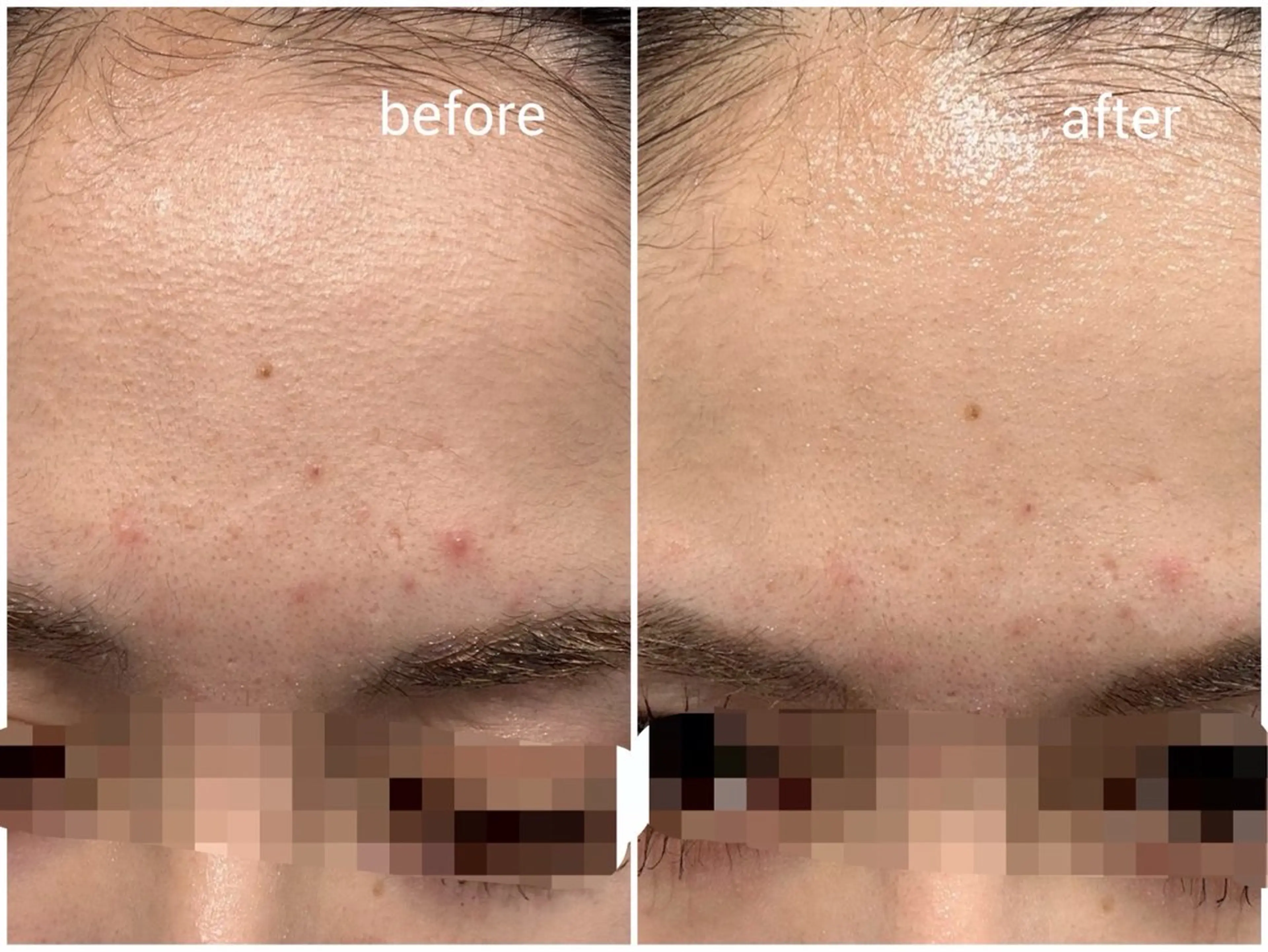 今西 彩夢 Minou心斎橋店のエステ・リラクイメージ