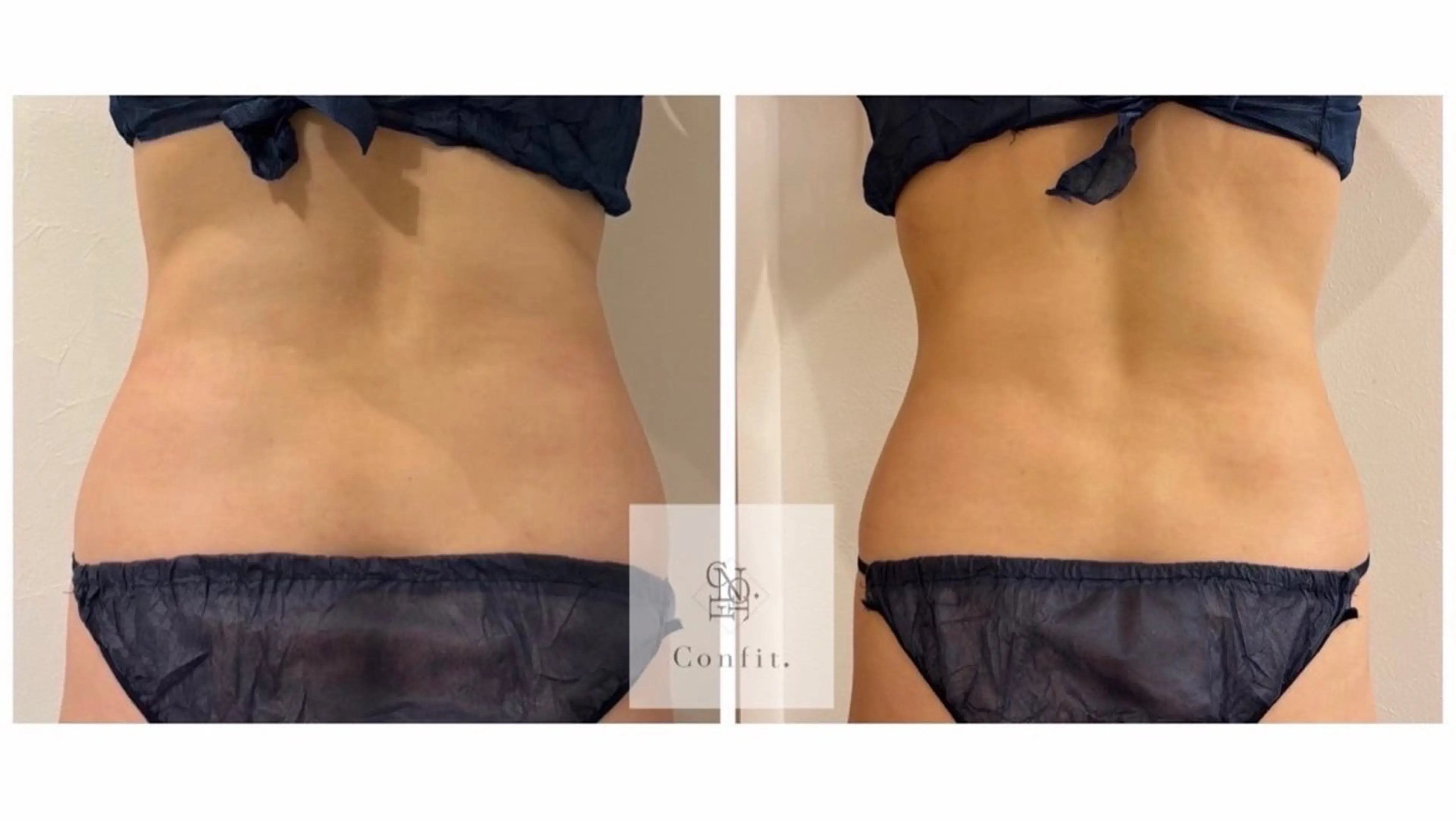 エステ 【小顔痩身専門看護師 サロンSONA】のエステ・リラクイメージ