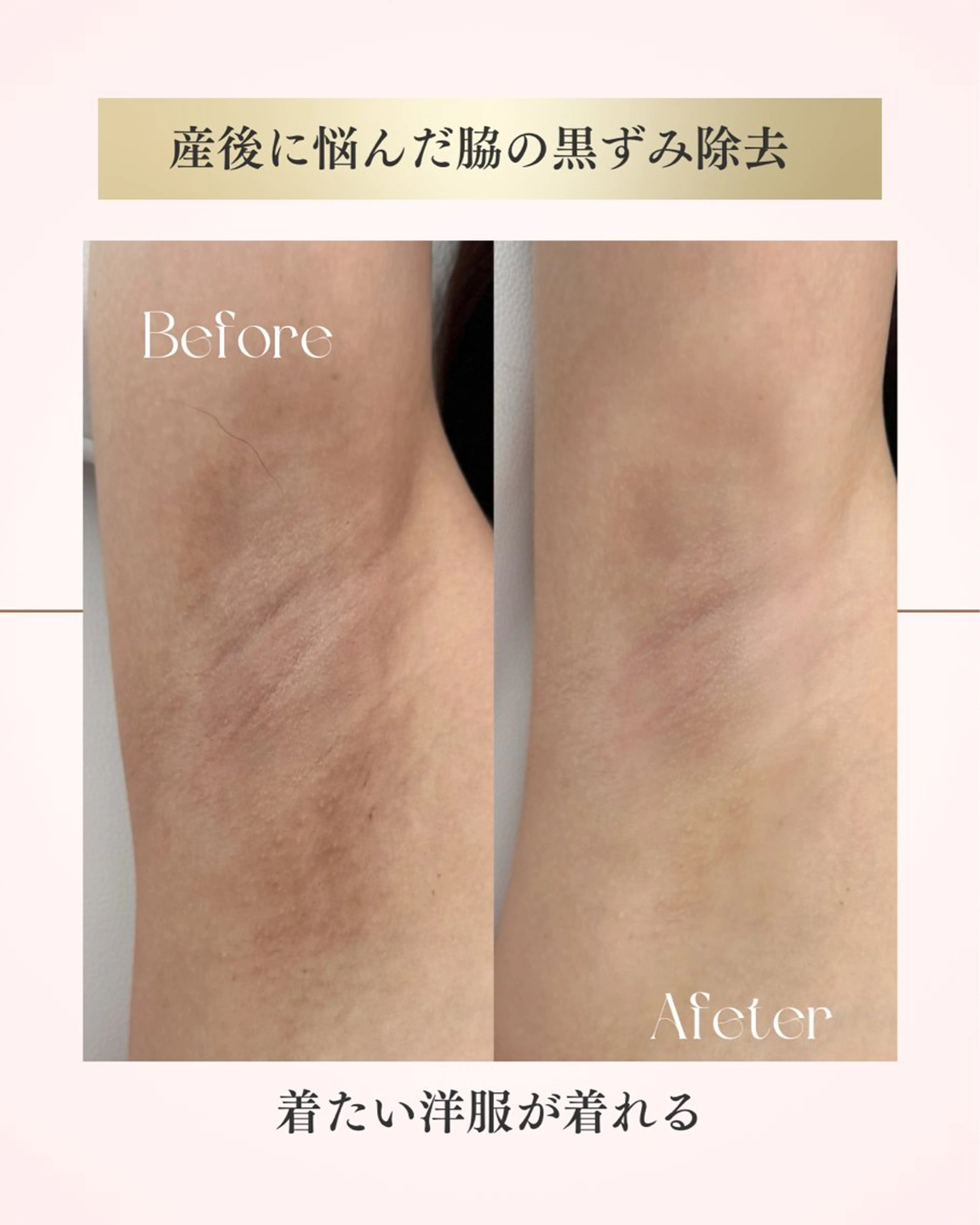 Raviy 【痩身専門・肌管理】のエステ・リラクイメージ
