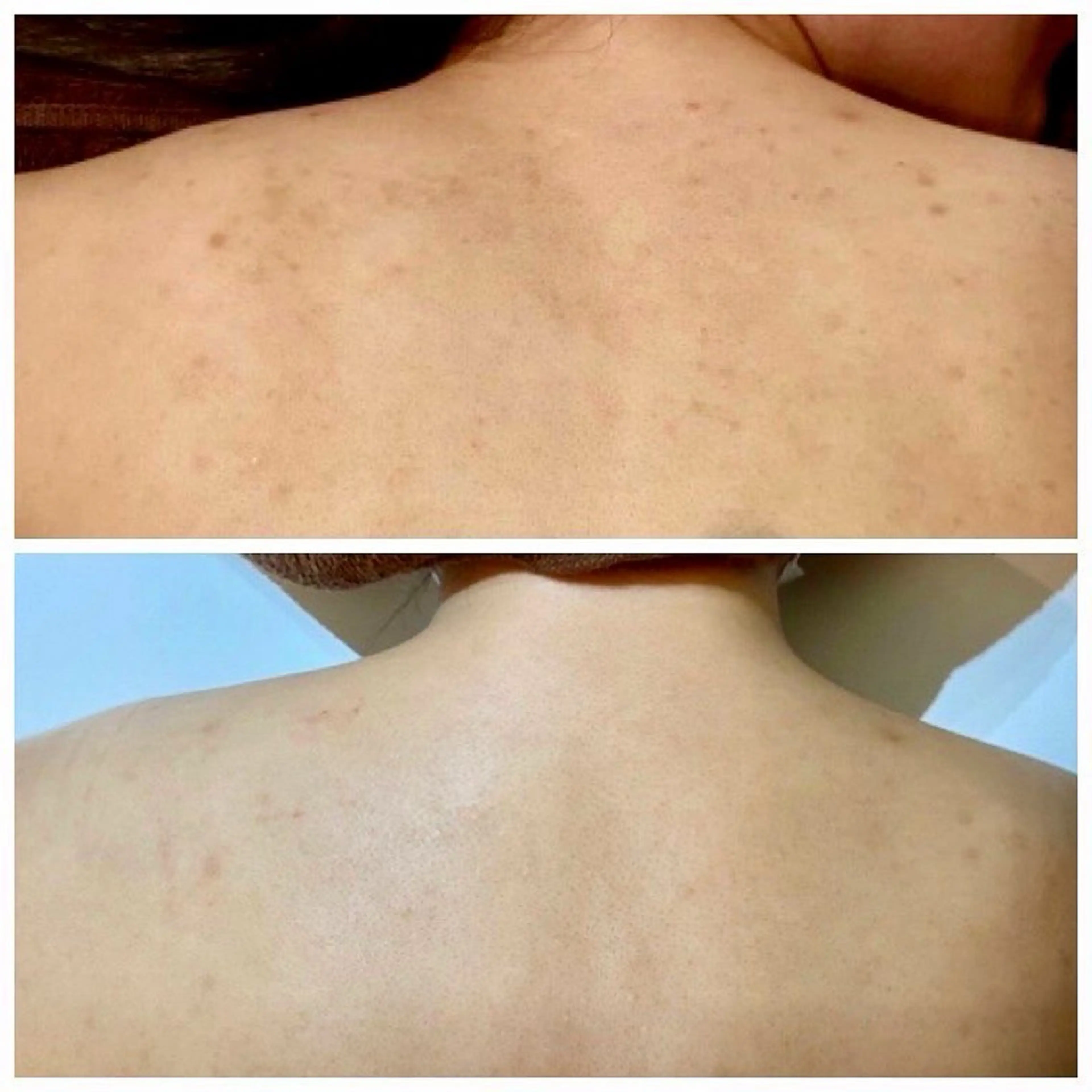 Flourb所属・ハーブピーリング専門 サロンFlourbのエステ・リラクイメージ