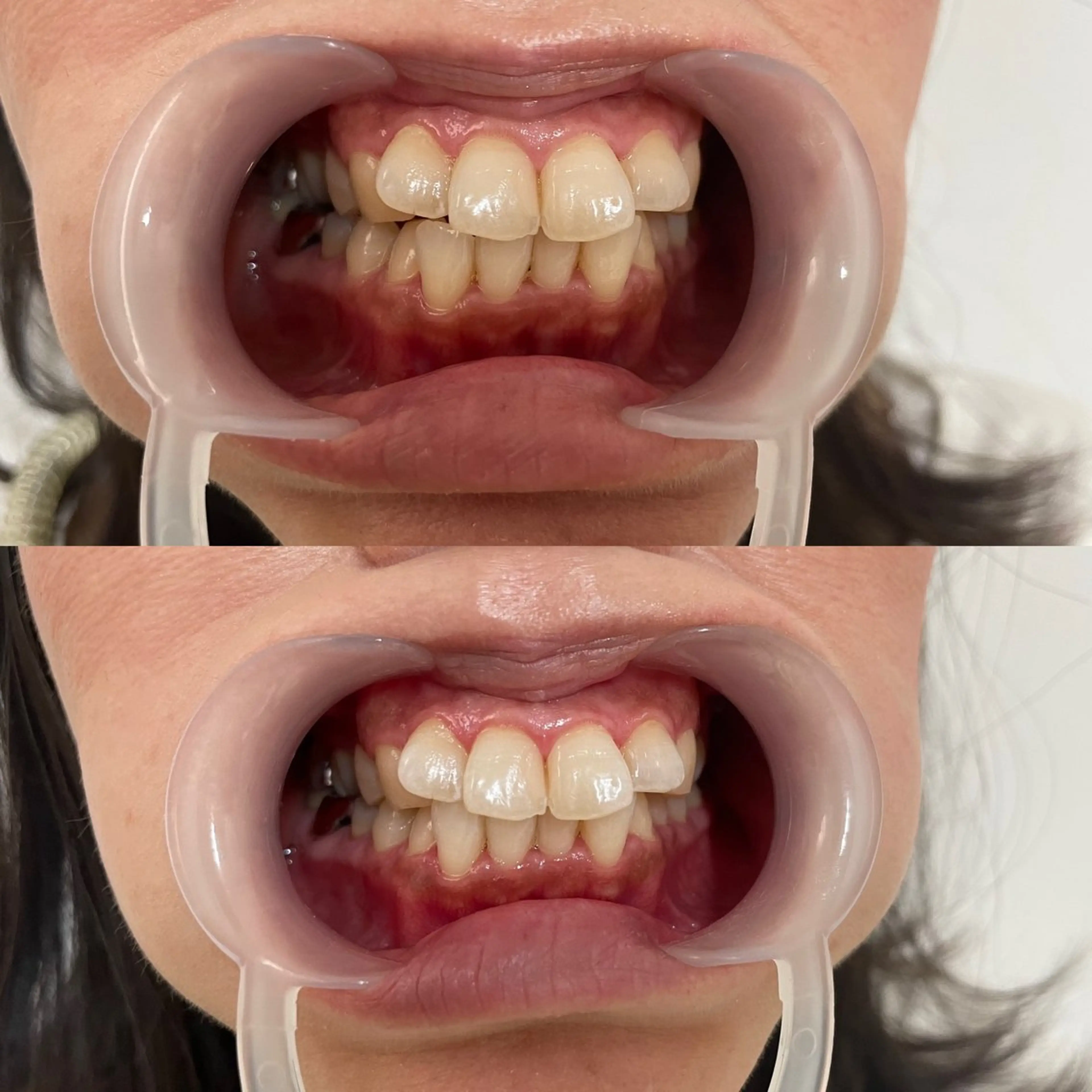 西宮ホワイトニング Kirarie所属・志水 有美のエステ・リラクイメージ