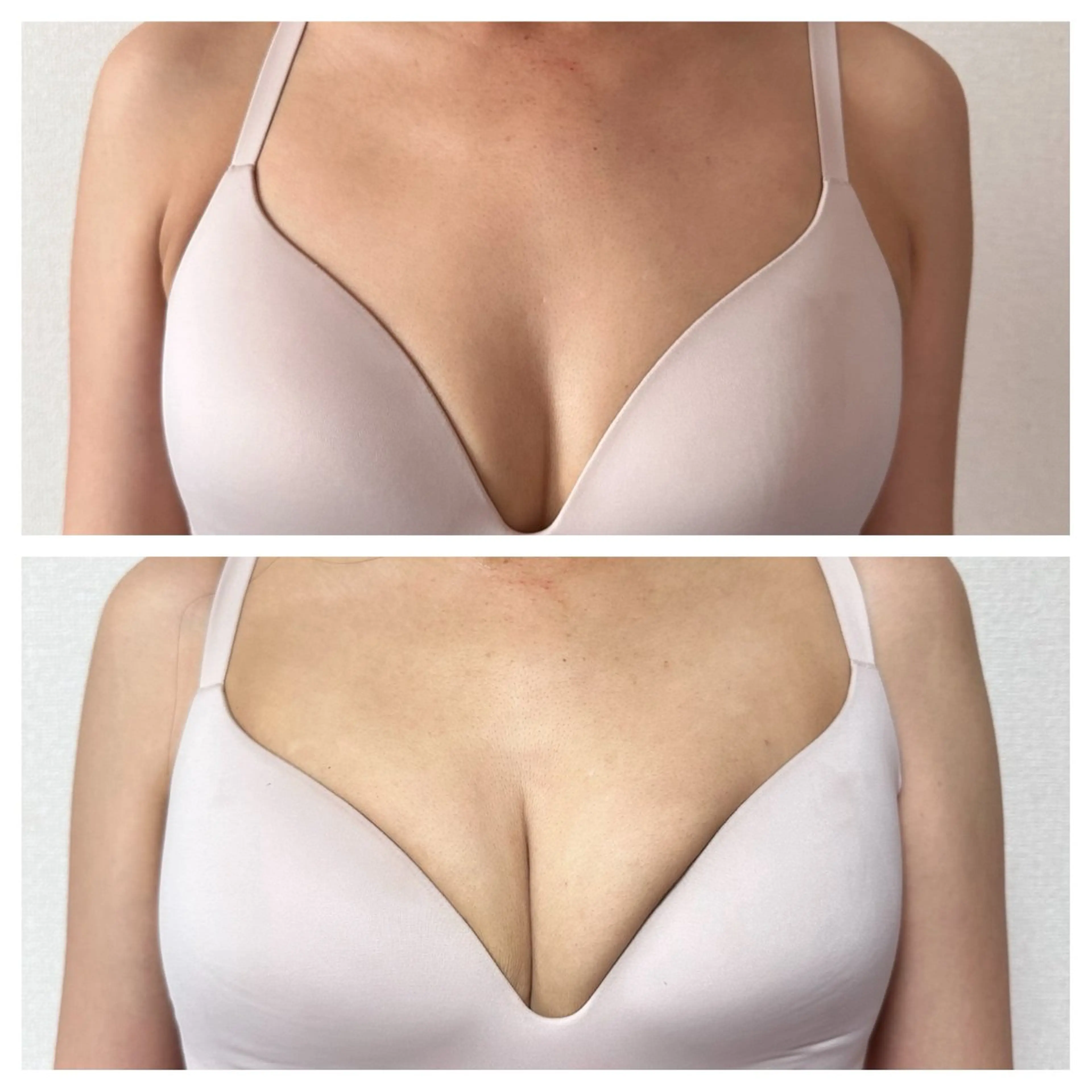 エステ Miel所属・バストアップサロン Mielのエステ・リラクイメージ