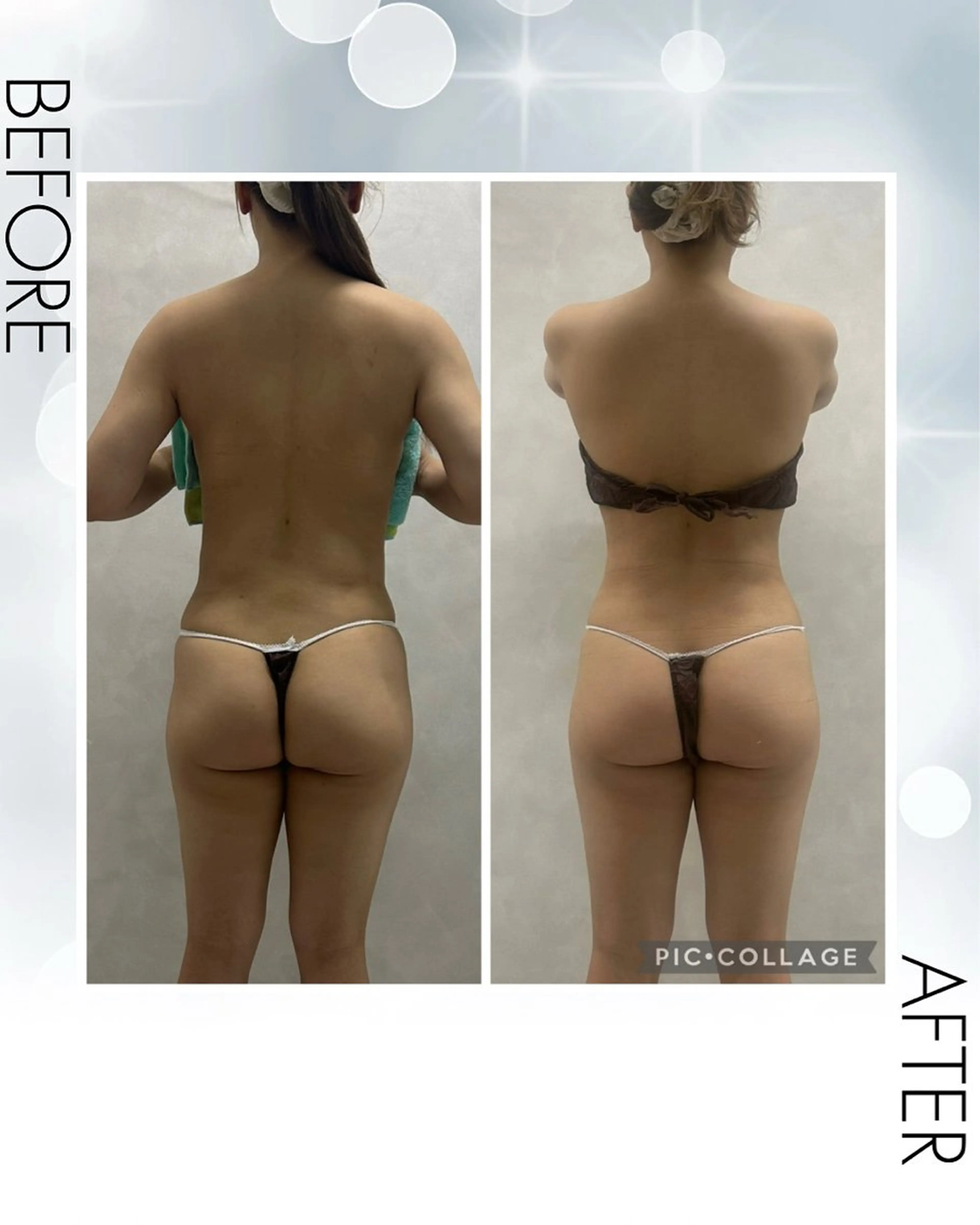 エステ 痩身専門エステサロン Eclatのエステ・リラクイメージ