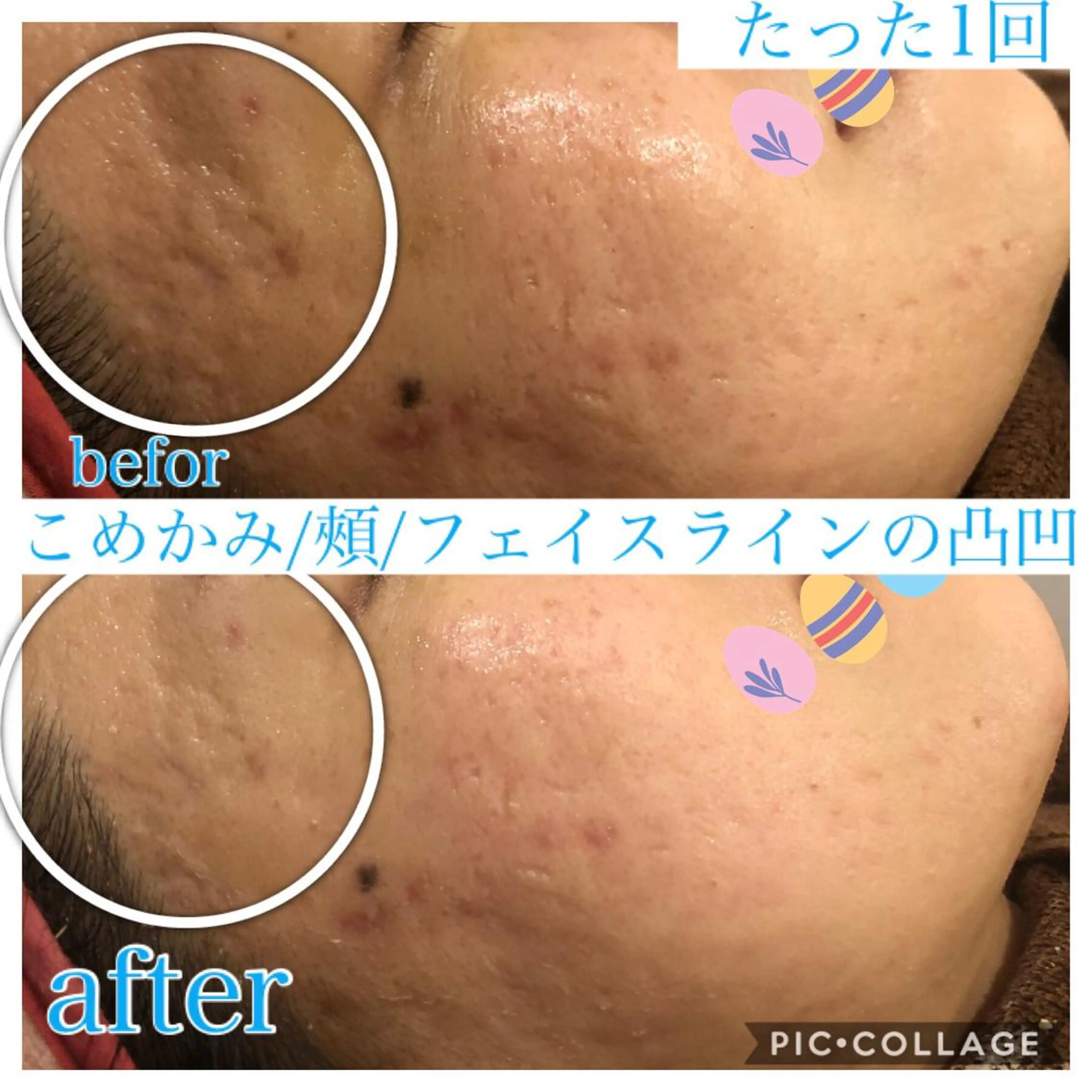 ミディアム カラー パーマ ヘアアレンジ キッズ ネイル マツエク・マツパ エステ リラク EnsorClair 代表 野口真央のエステ・リラクイメージ
