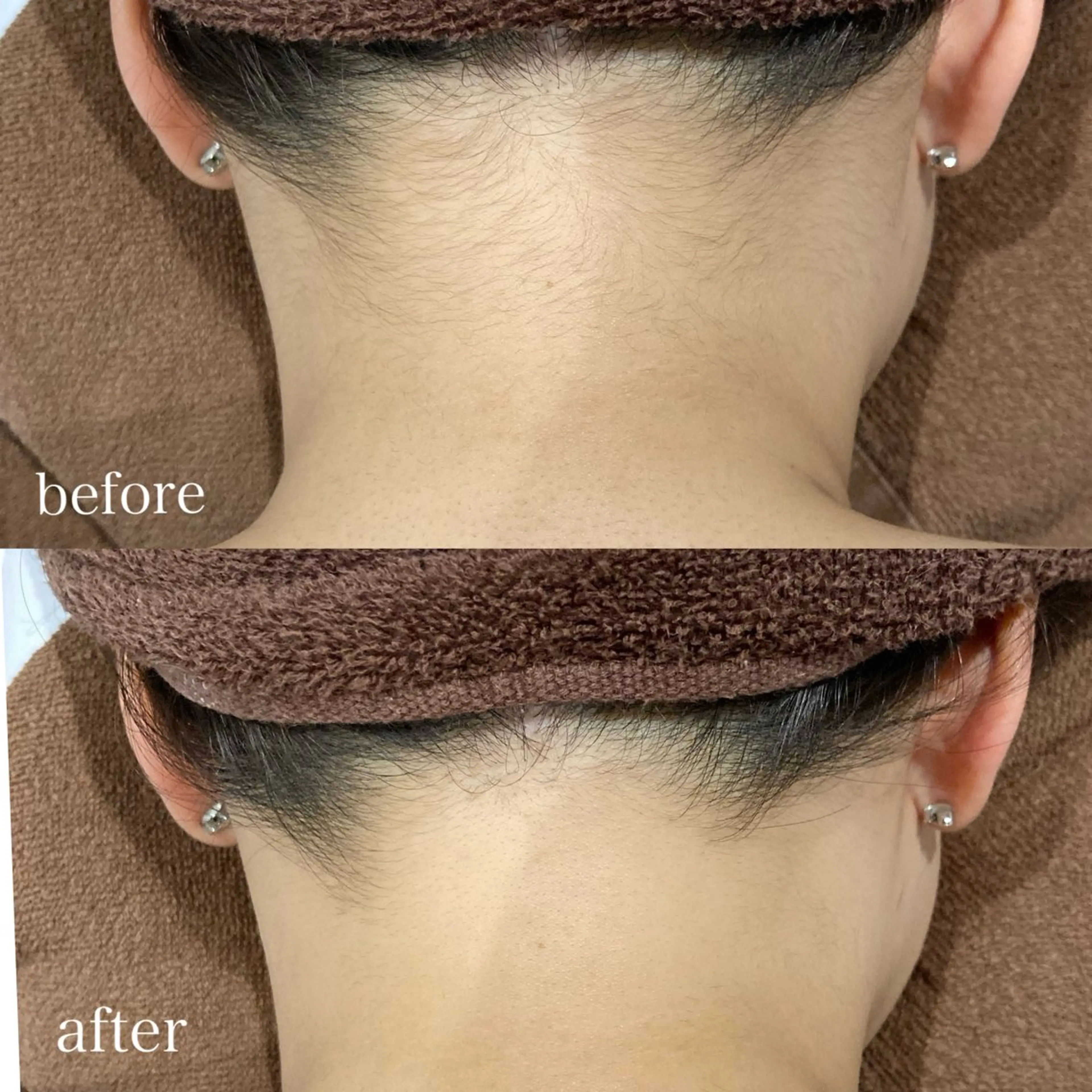 脱毛 Dahlia痩身脱毛 フェイシャル 中村のエステ・リラクイメージ