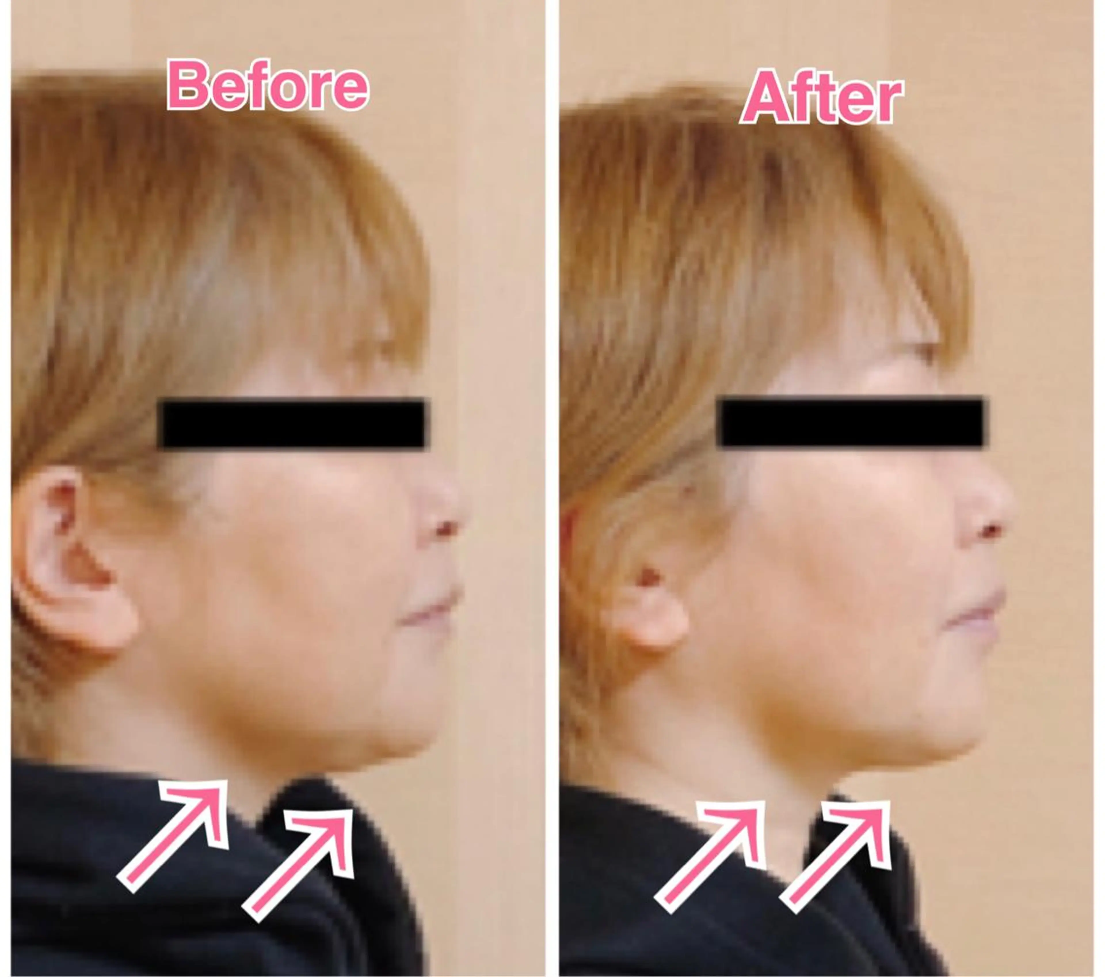 小顔・デトックスリンパ専門サロンRadiant Muse (ラディアントミューズ)所属・小顔・たるみ改善 ラディアントミューズのエステ・リラクイメージ