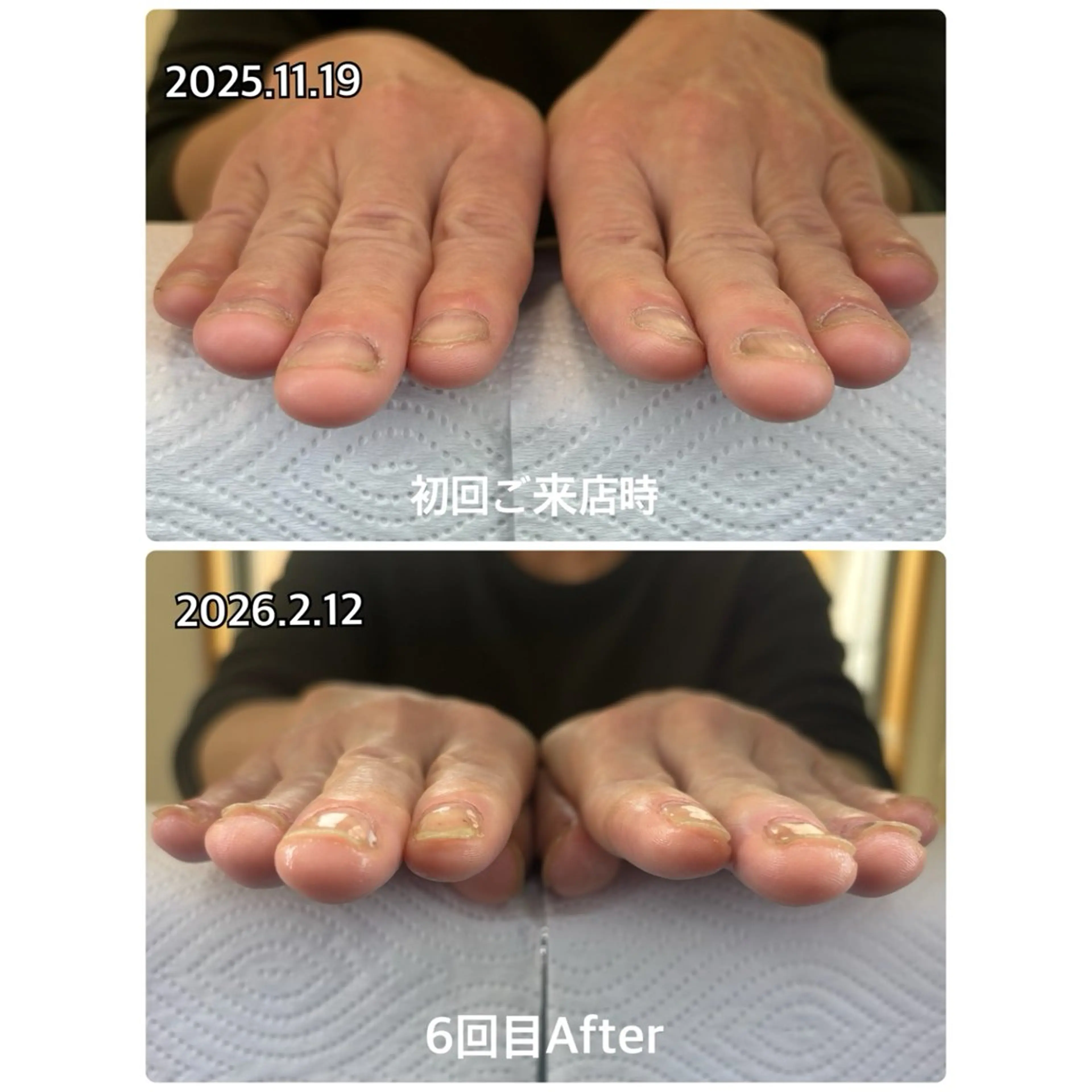 ネイル ハンドケア 高木 みどりのネイルデザイン