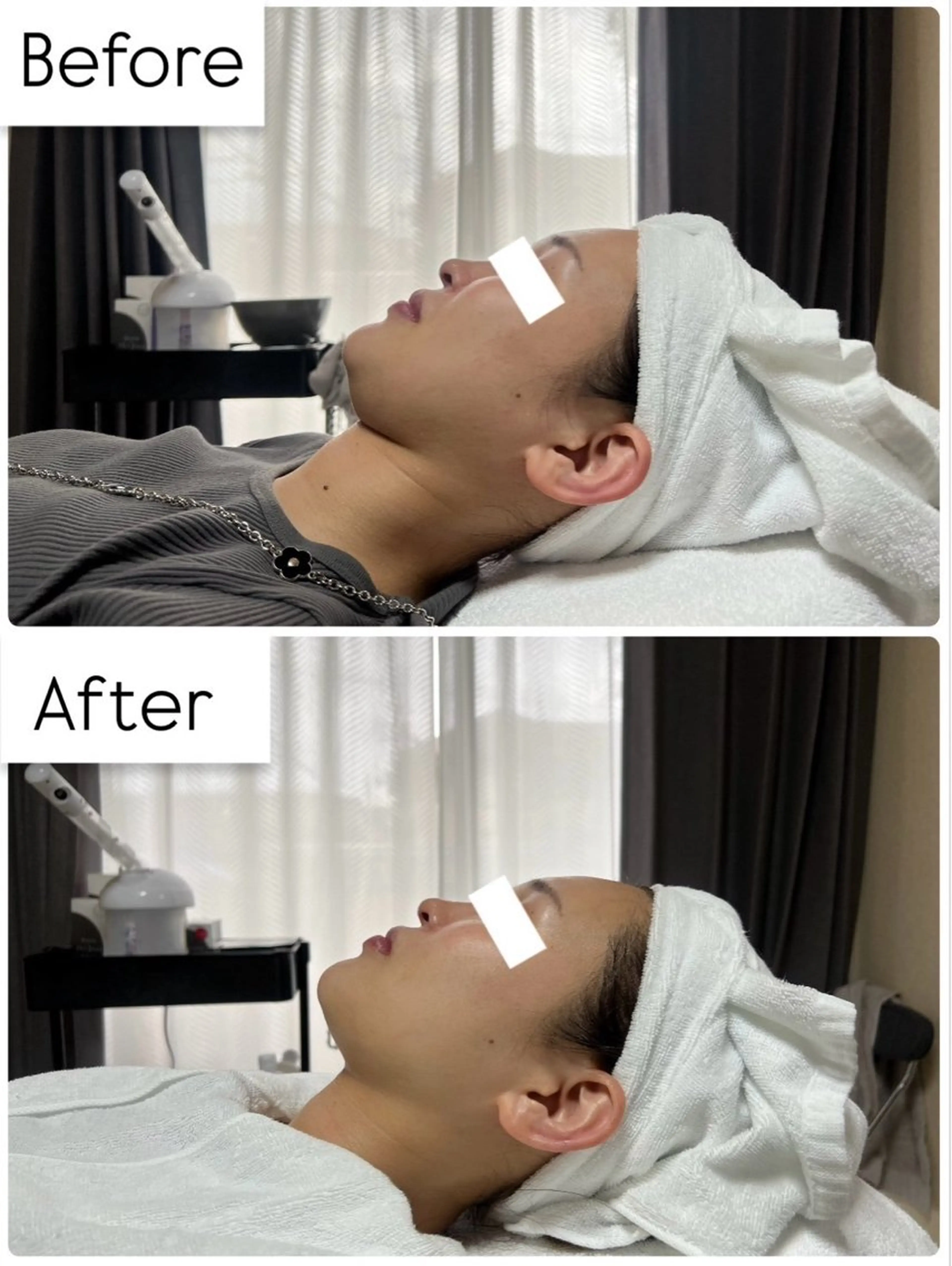 ROR Nanaのネイルデザイン