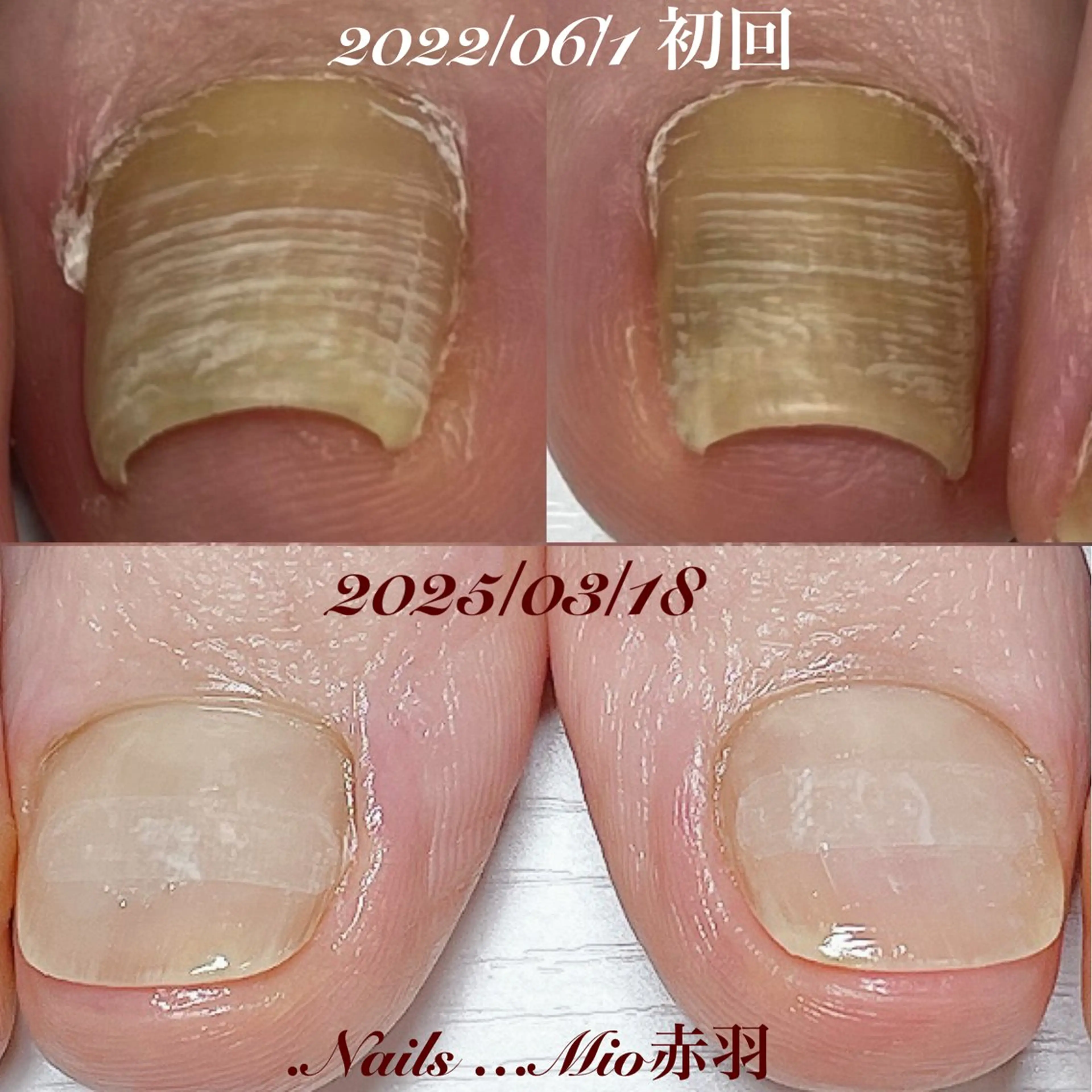ネイル フットネイル 赤色 .Nails Mio 赤羽西ネイルサロンのネイルデザイン