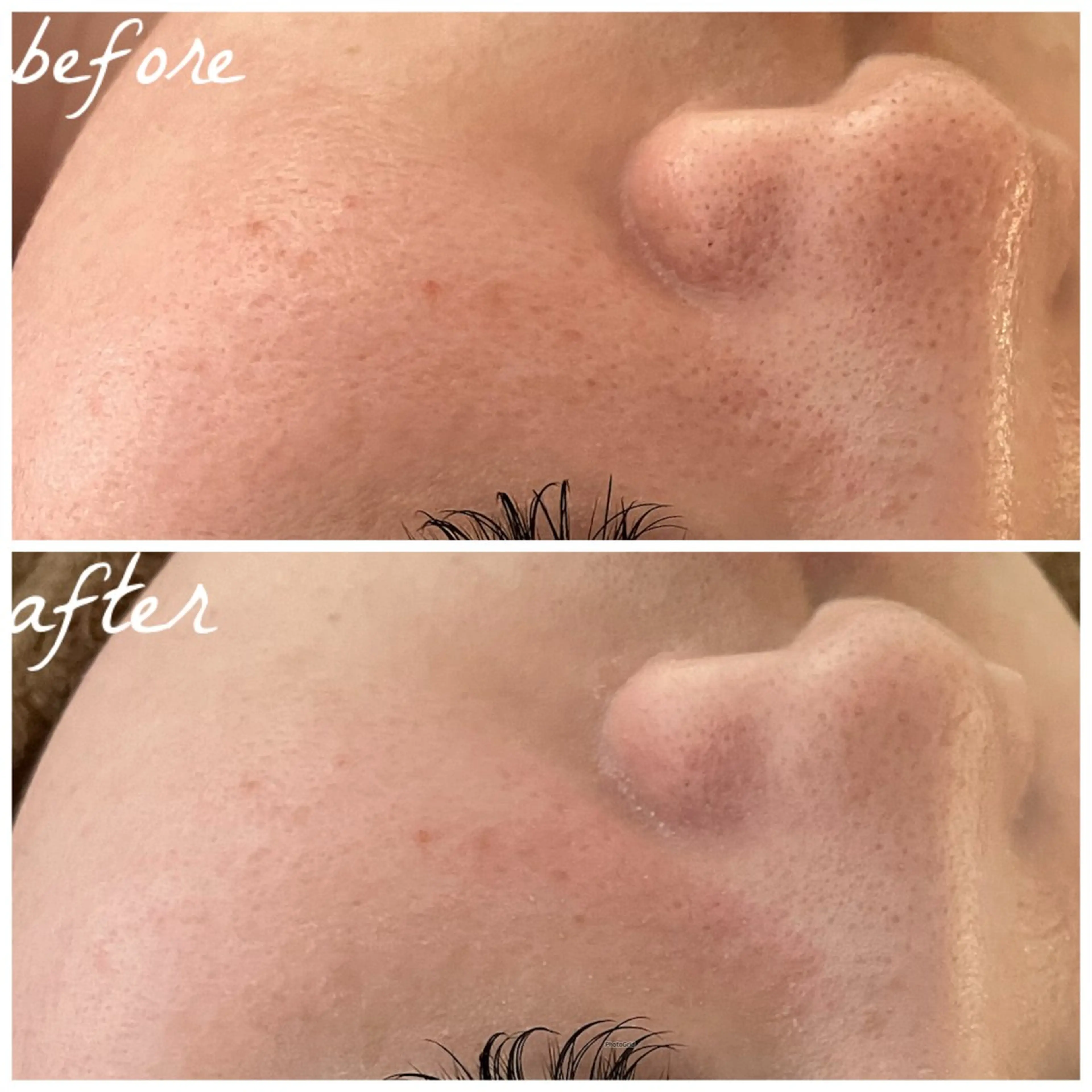 メンズ エステ メナード岐阜市茜部 杉浦のエステ・リラクイメージ