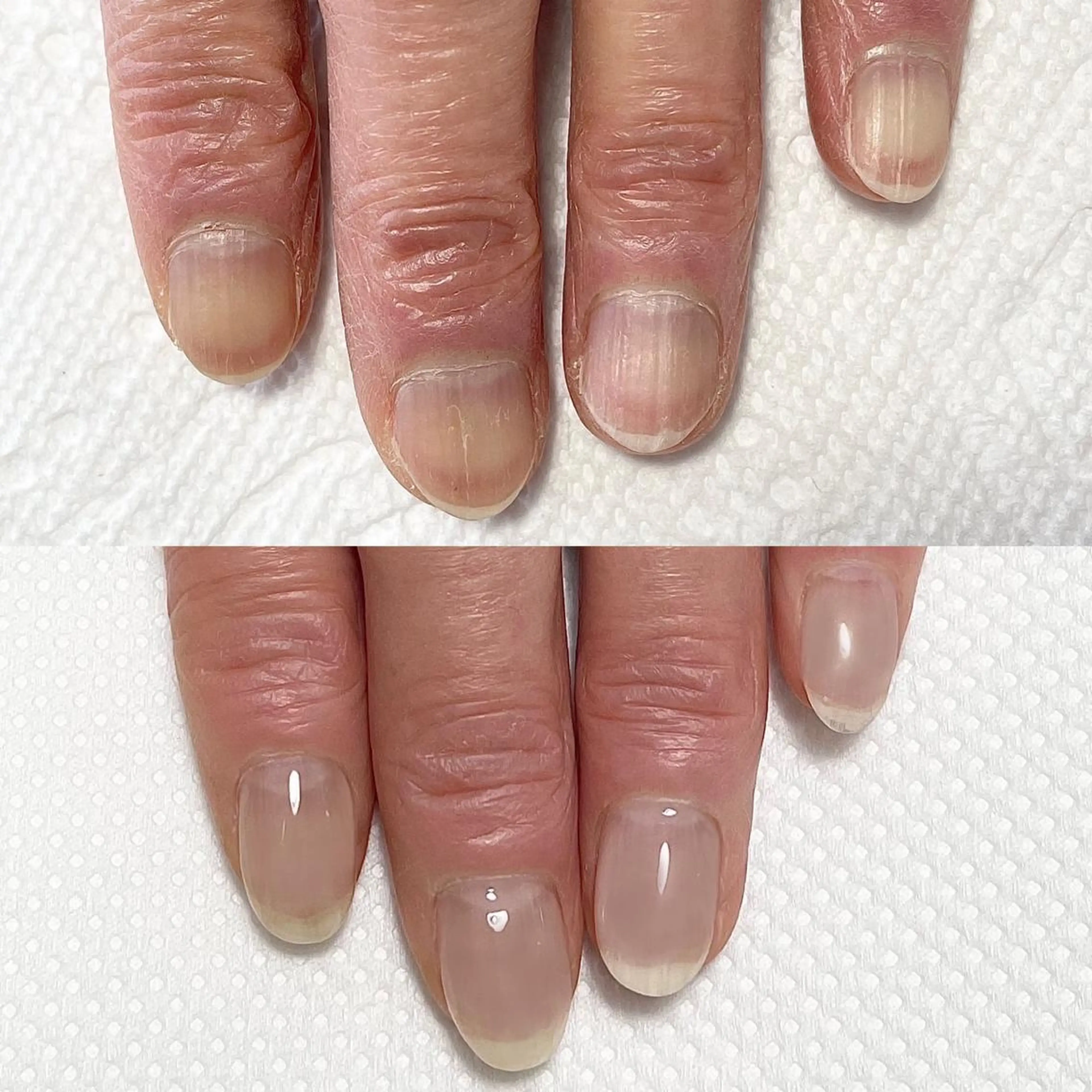 期間限定価格🌺お試し地爪育成🌺初回カウンセリング込の写真