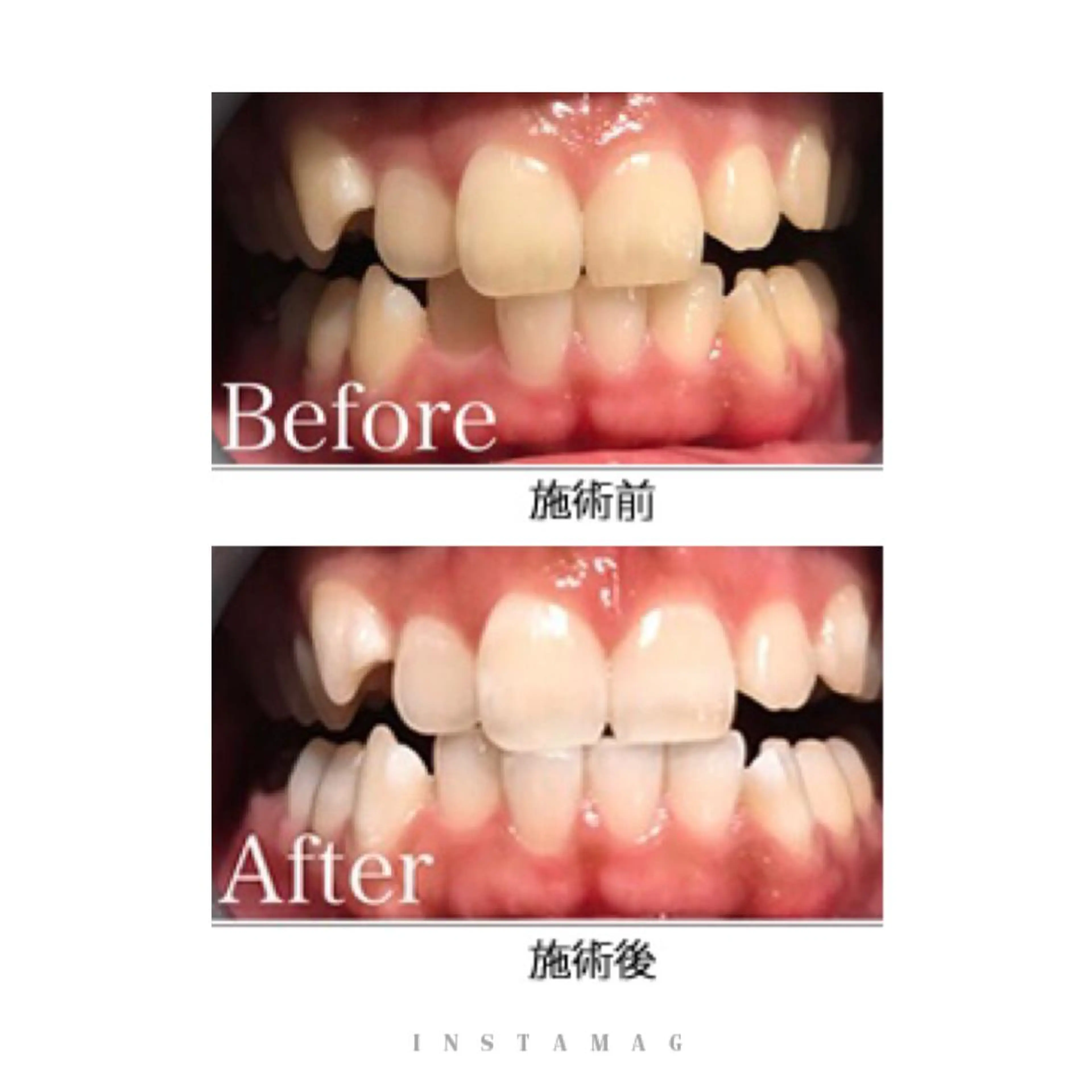 鍼灸 Refineのその他イメージ