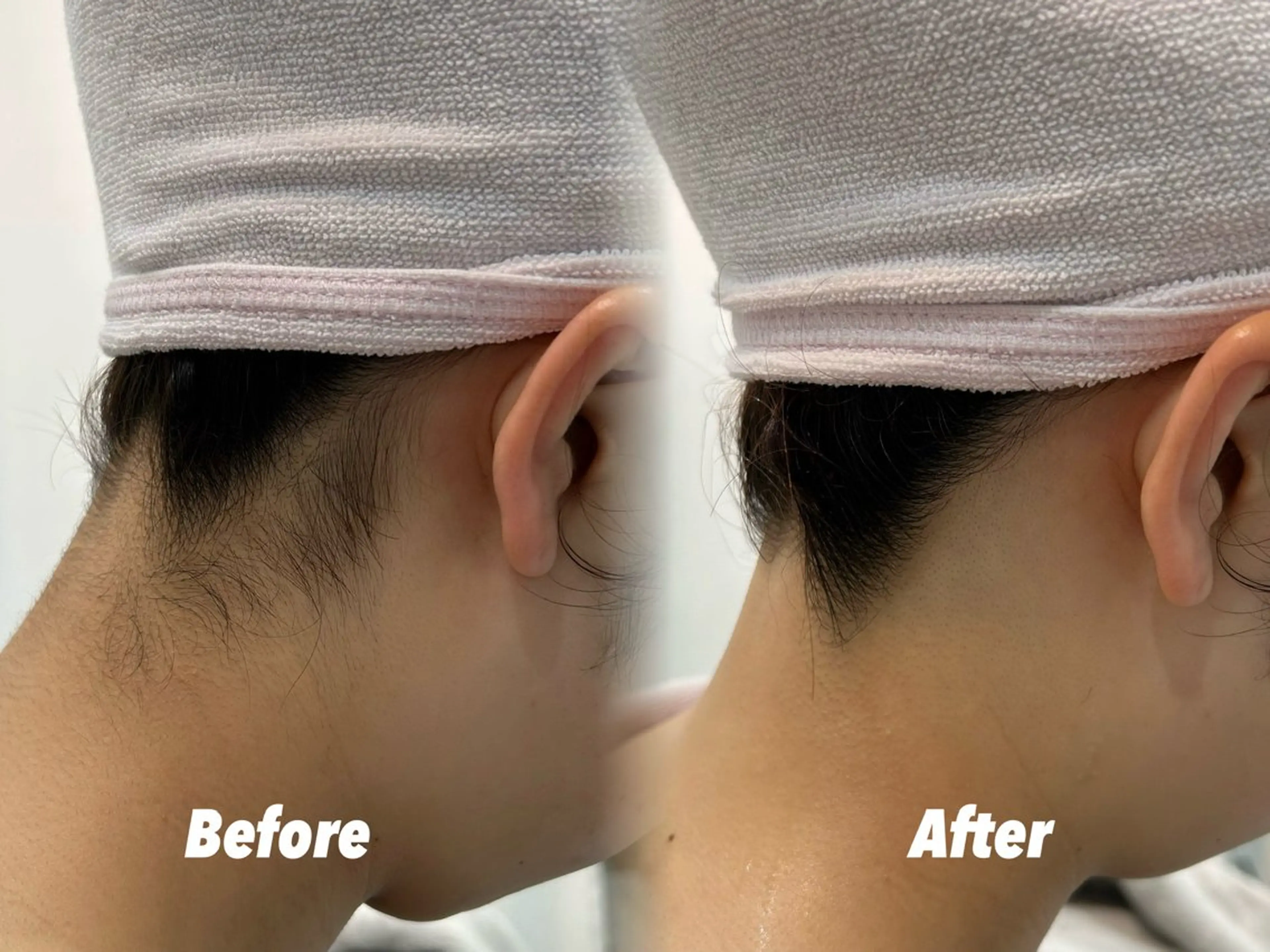 その他 🫧美しい素肌へ🫧 今成柚乃のその他イメージ