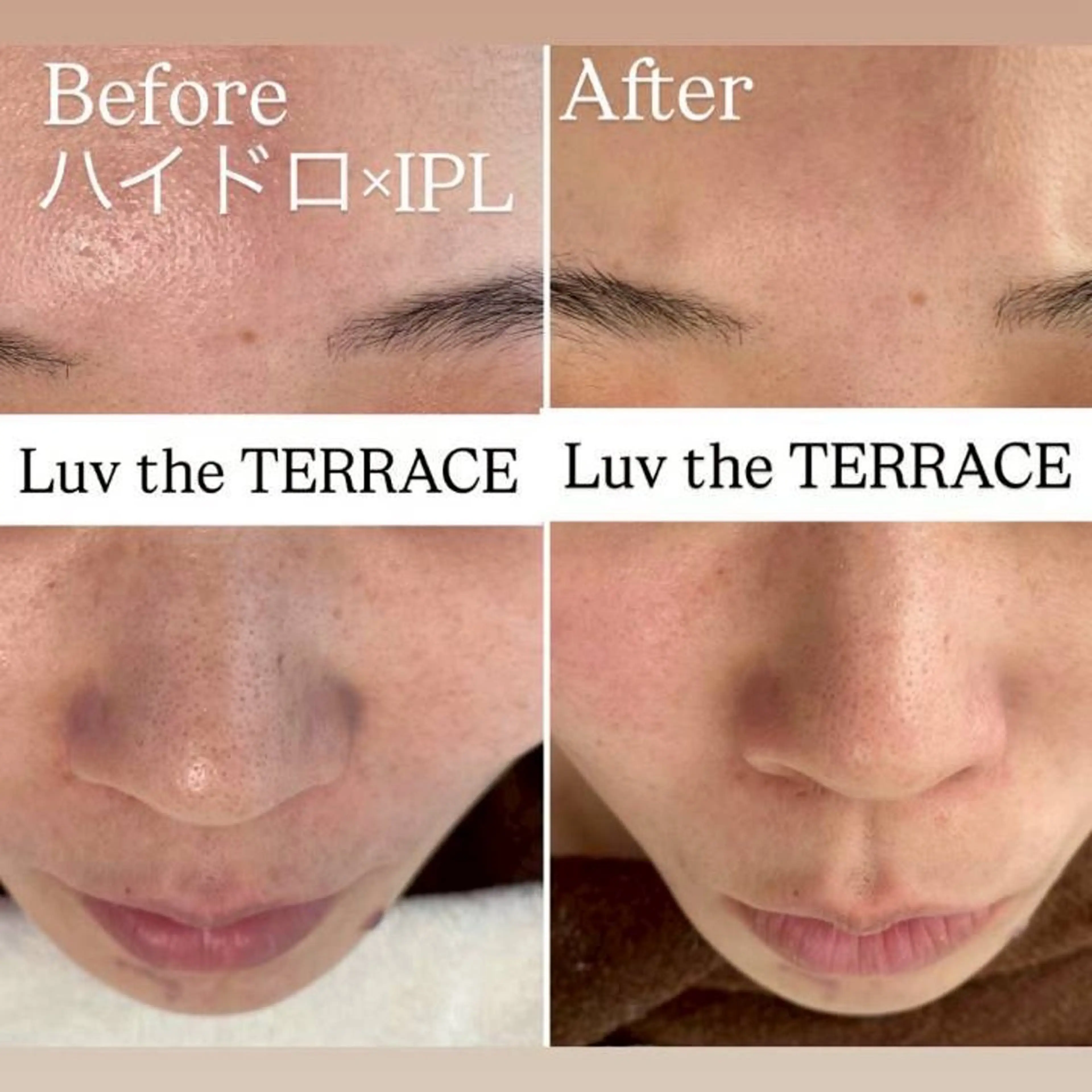 エステ Luv the TERRACEの眉毛・アイブロウイメージ