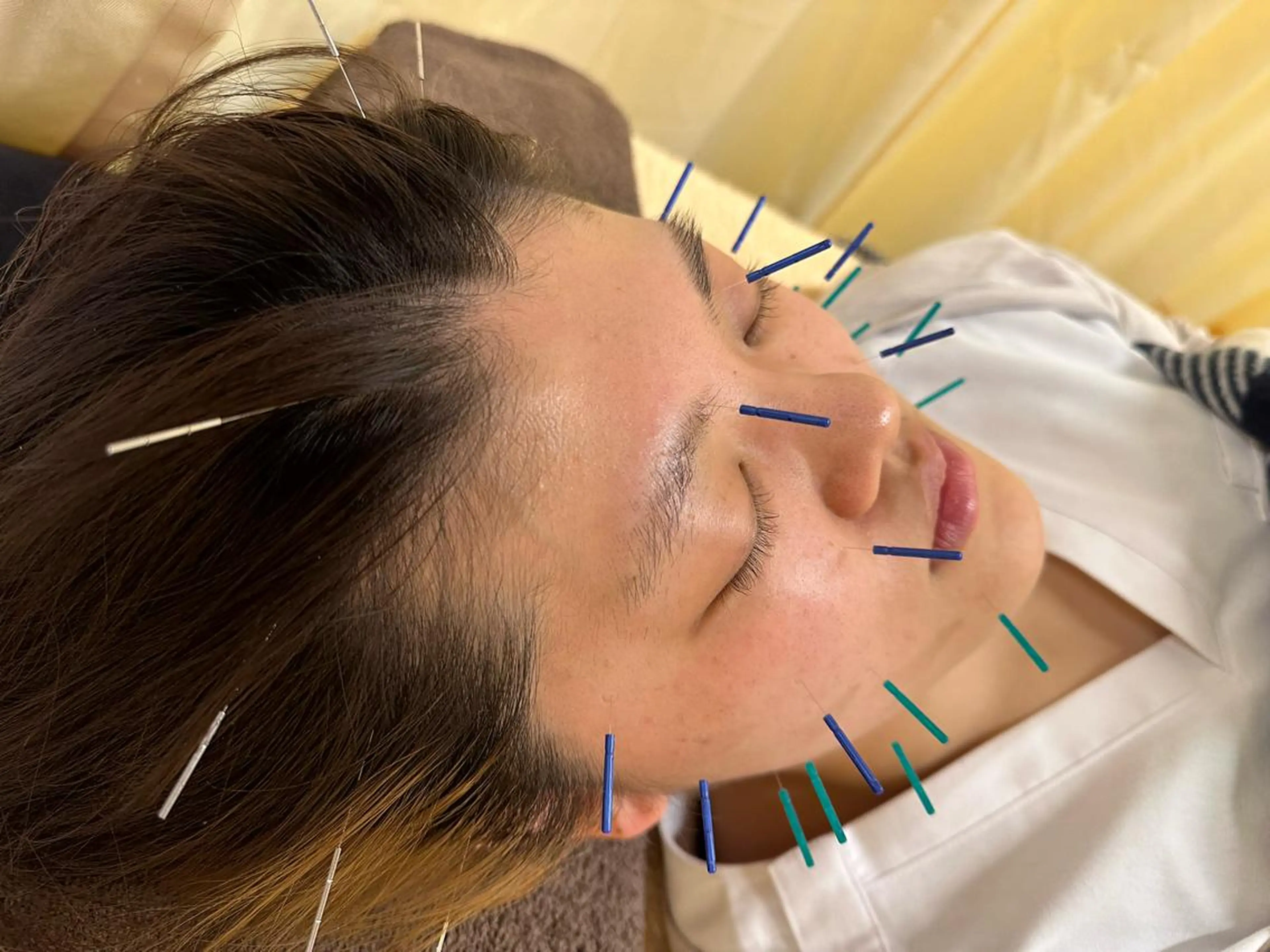 その他 鍼灸サロン BBB3のその他イメージ