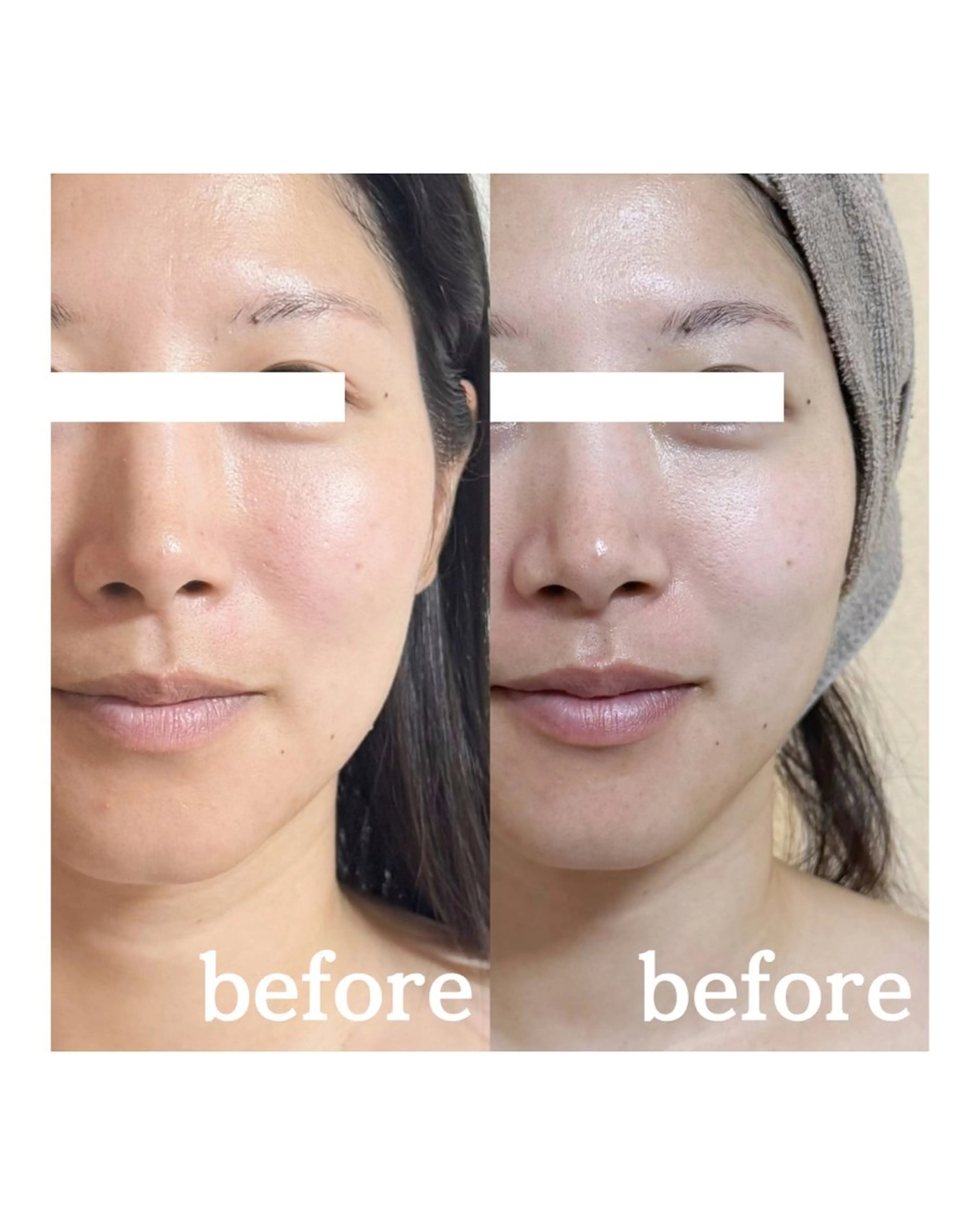 Mignon Luluのエステ・リラクイメージ