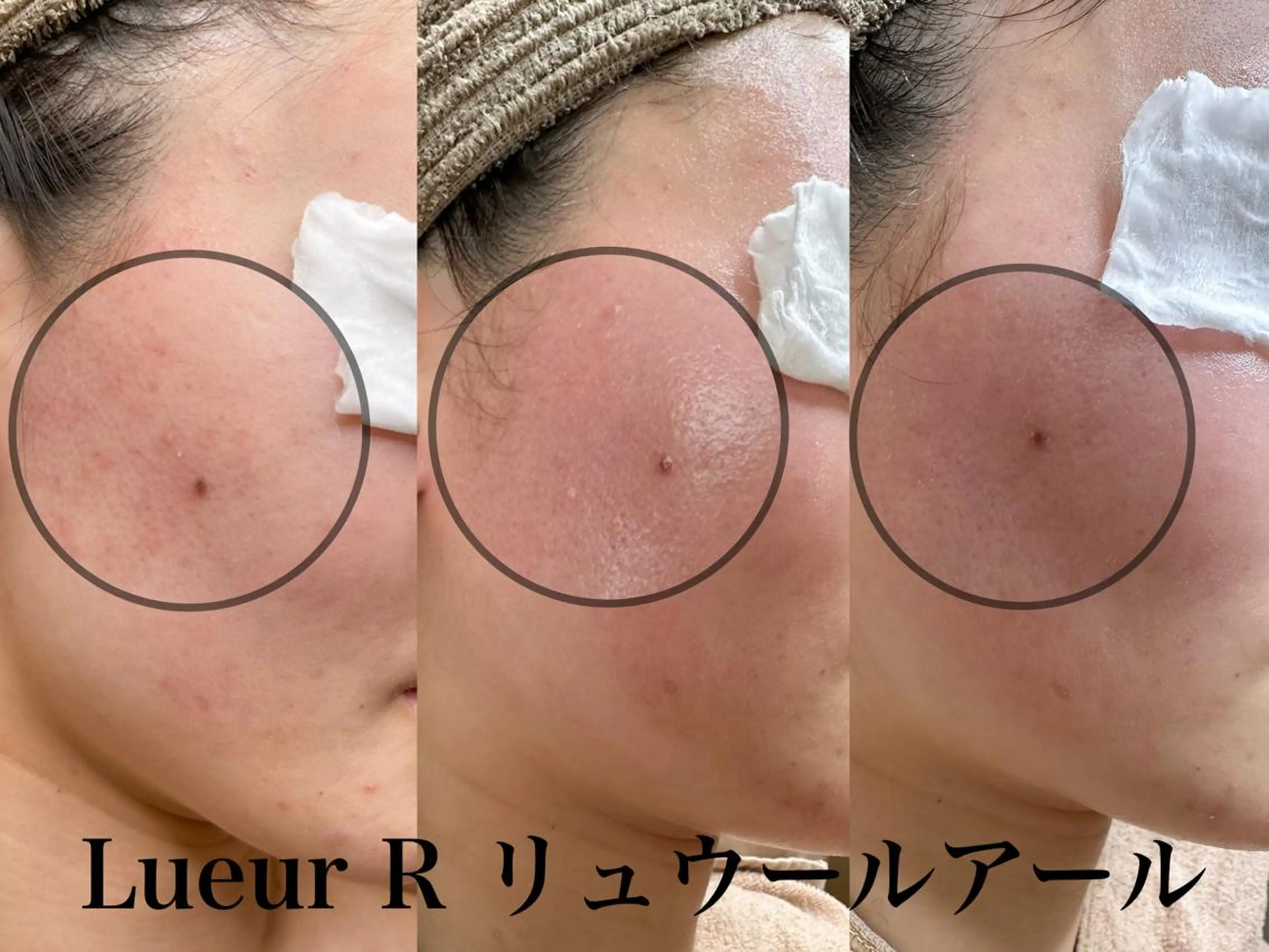 その他 大久保 里奈のエステ・リラクイメージ