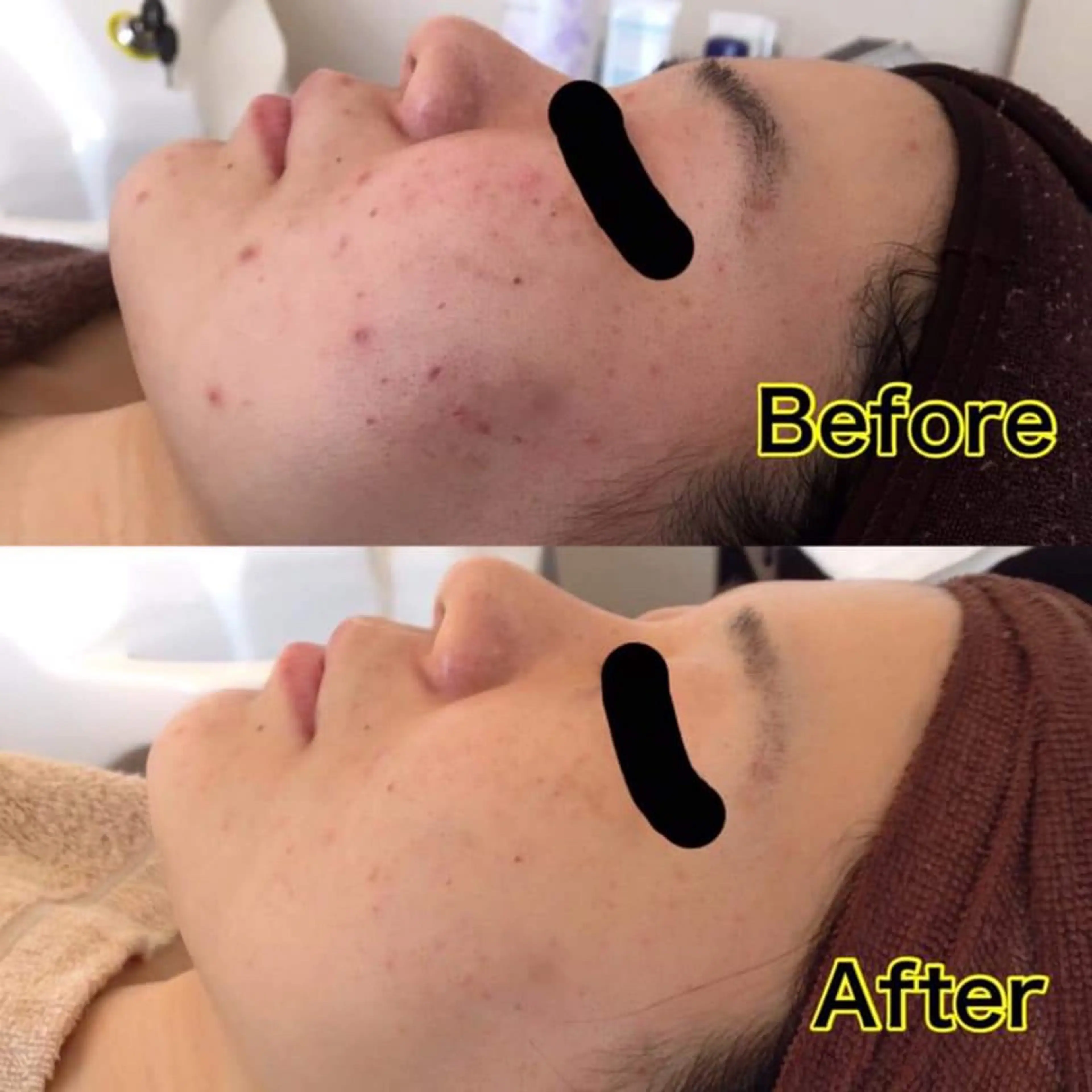 エステ vary  clue MISAのその他イメージ