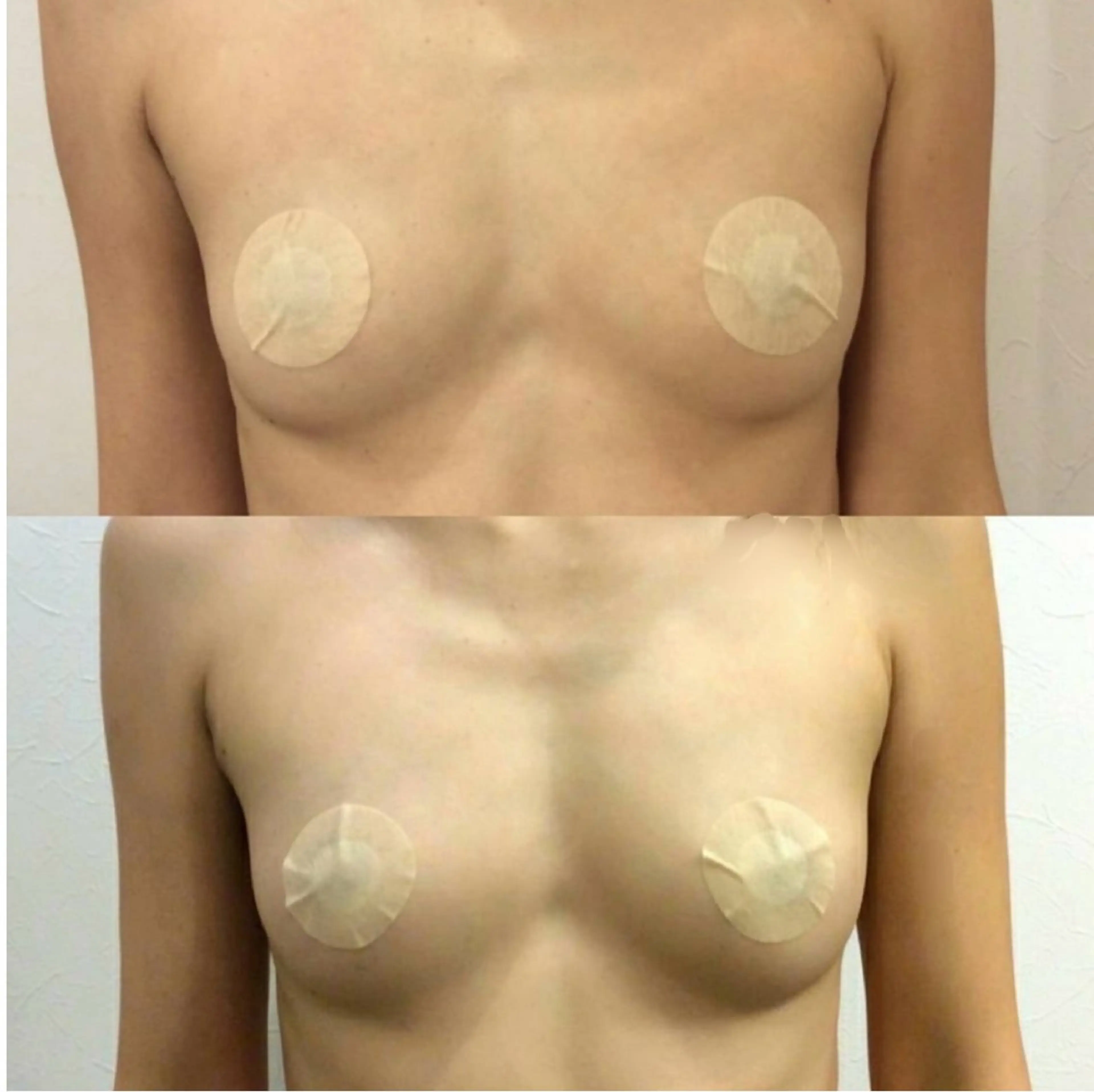 最新育乳マシン使用！ バストアップ専門店のその他イメージ