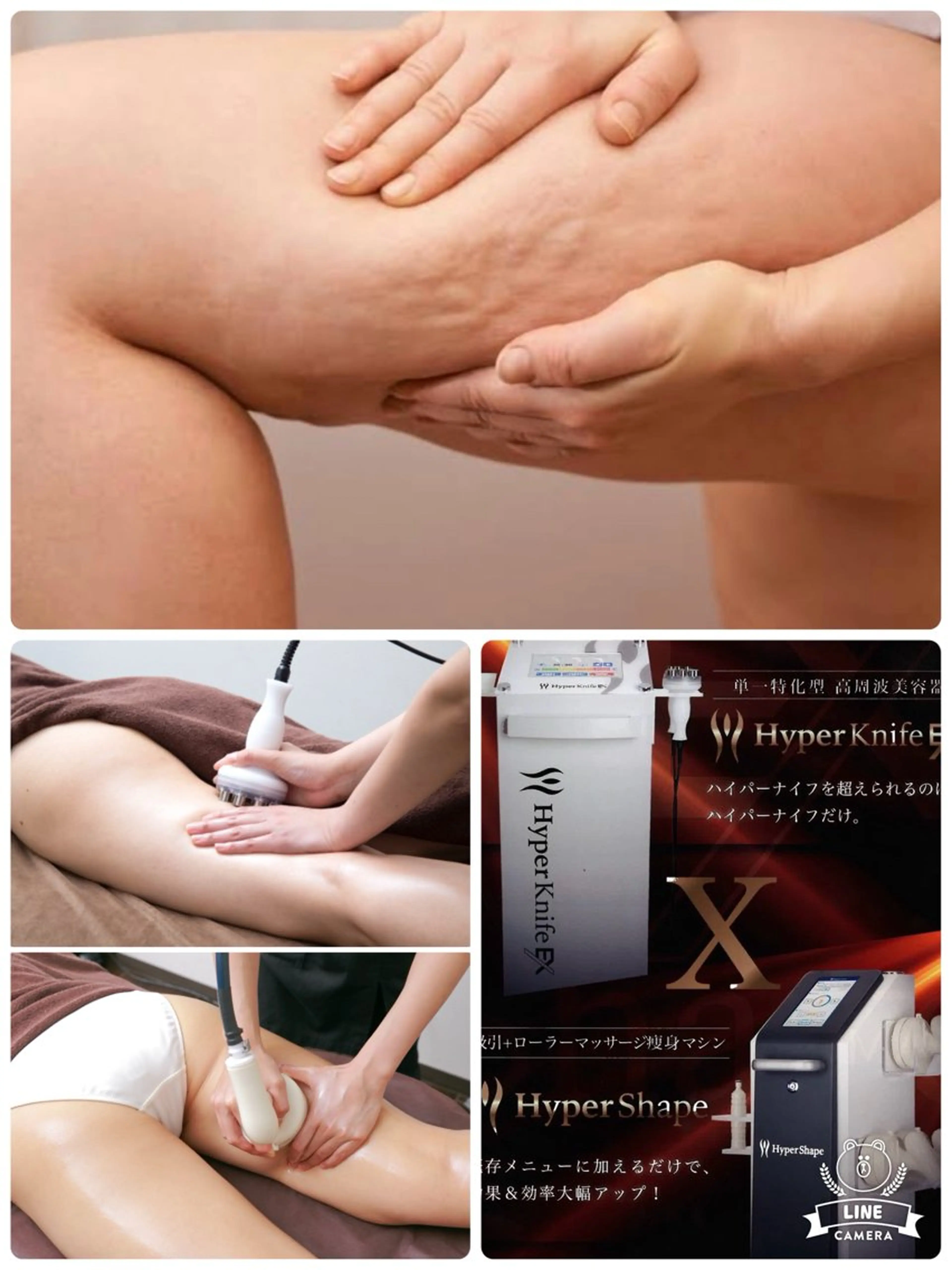 Wマシン+痩身リンパマッサージ+発汗70分☆ヘッドスパ付き¥9980の写真