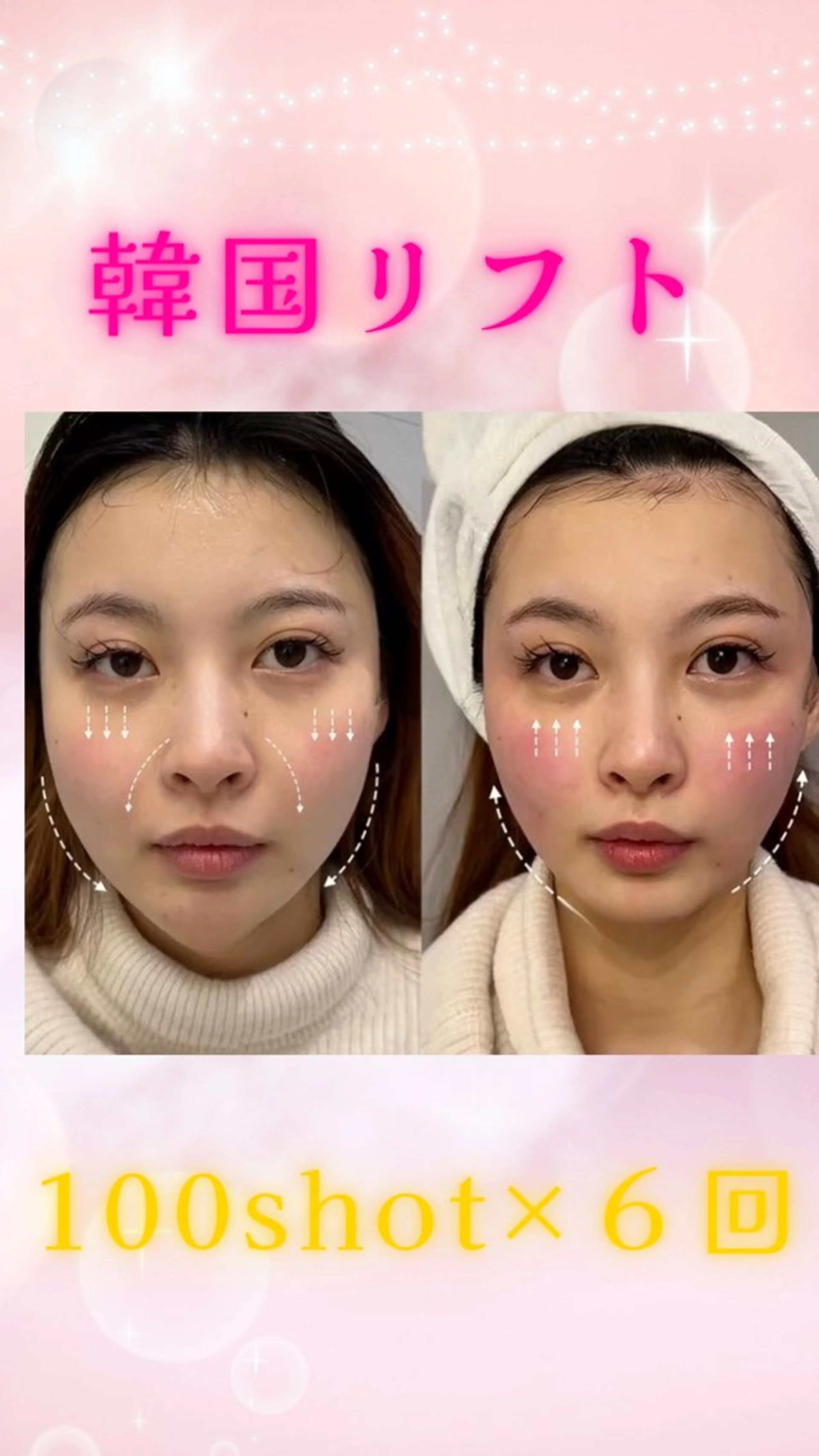 ショート エステ 愛維美水光美肌専門店 メンズレディースokのエステ・リラクイメージ