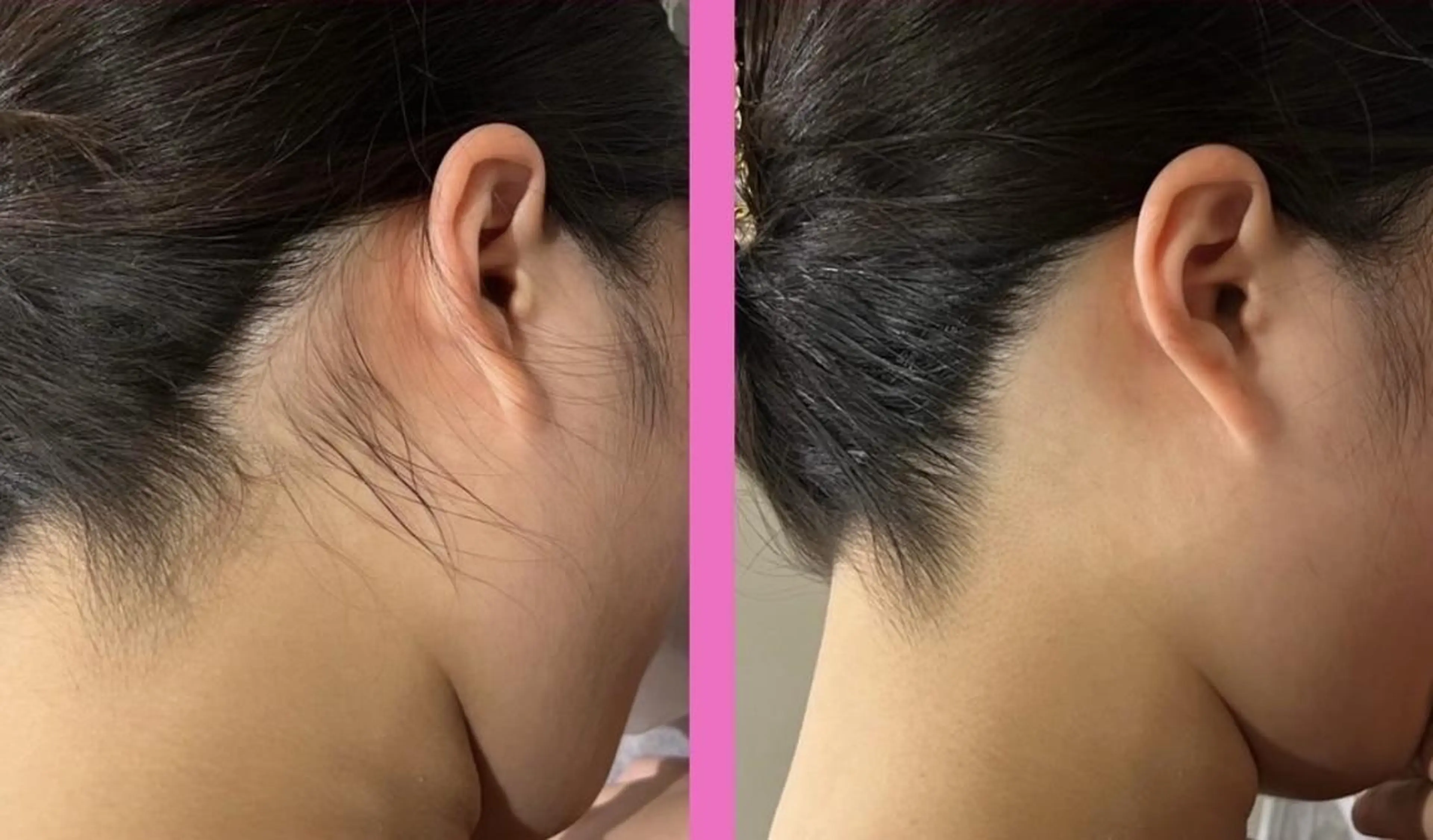 【天神・大名】脱毛/ ハーブ植松७९०のエステ・リラクイメージ