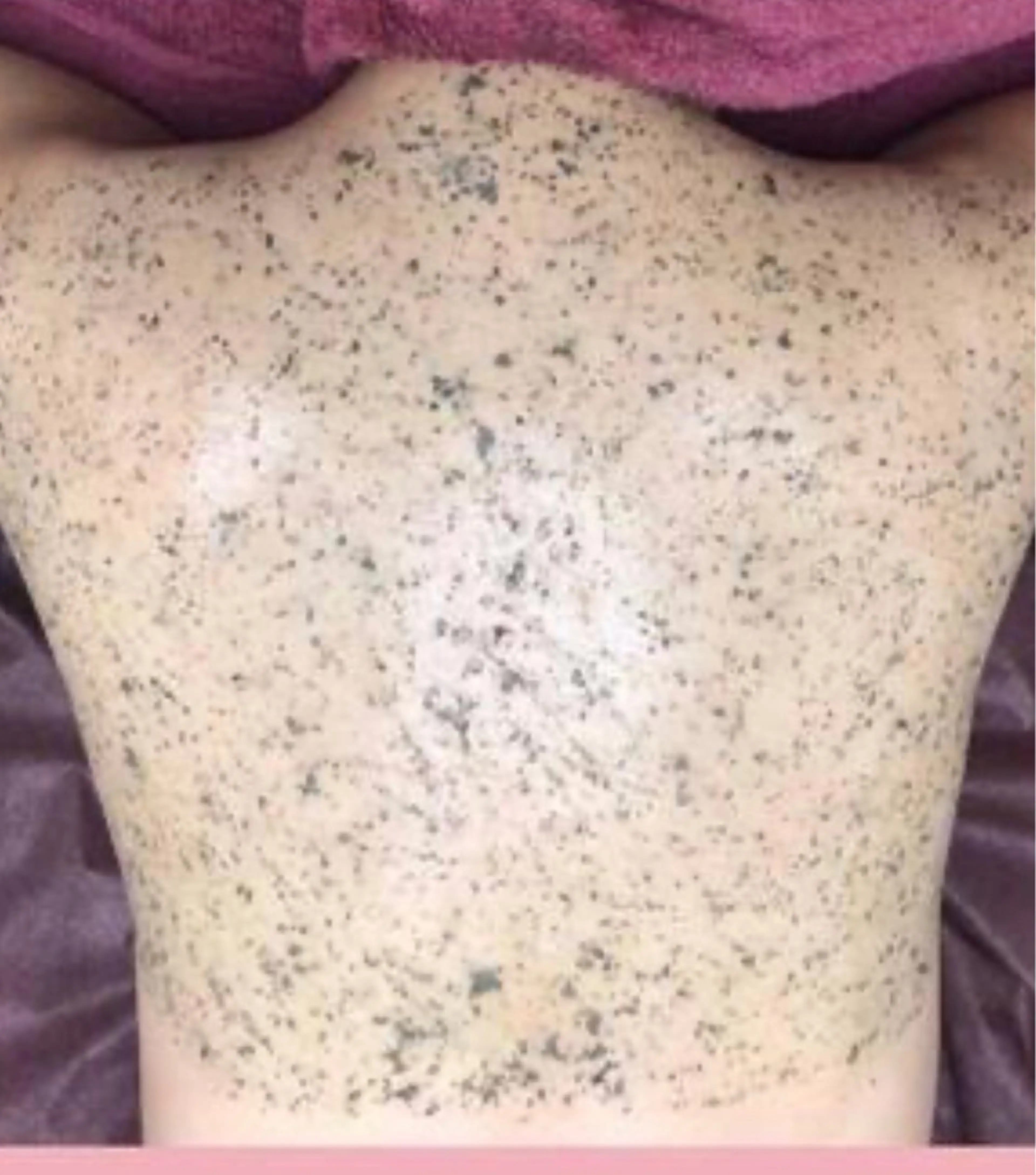 エステ ☺ハーブピール💕 ソフィアカロン💖のエステ・リラクイメージ