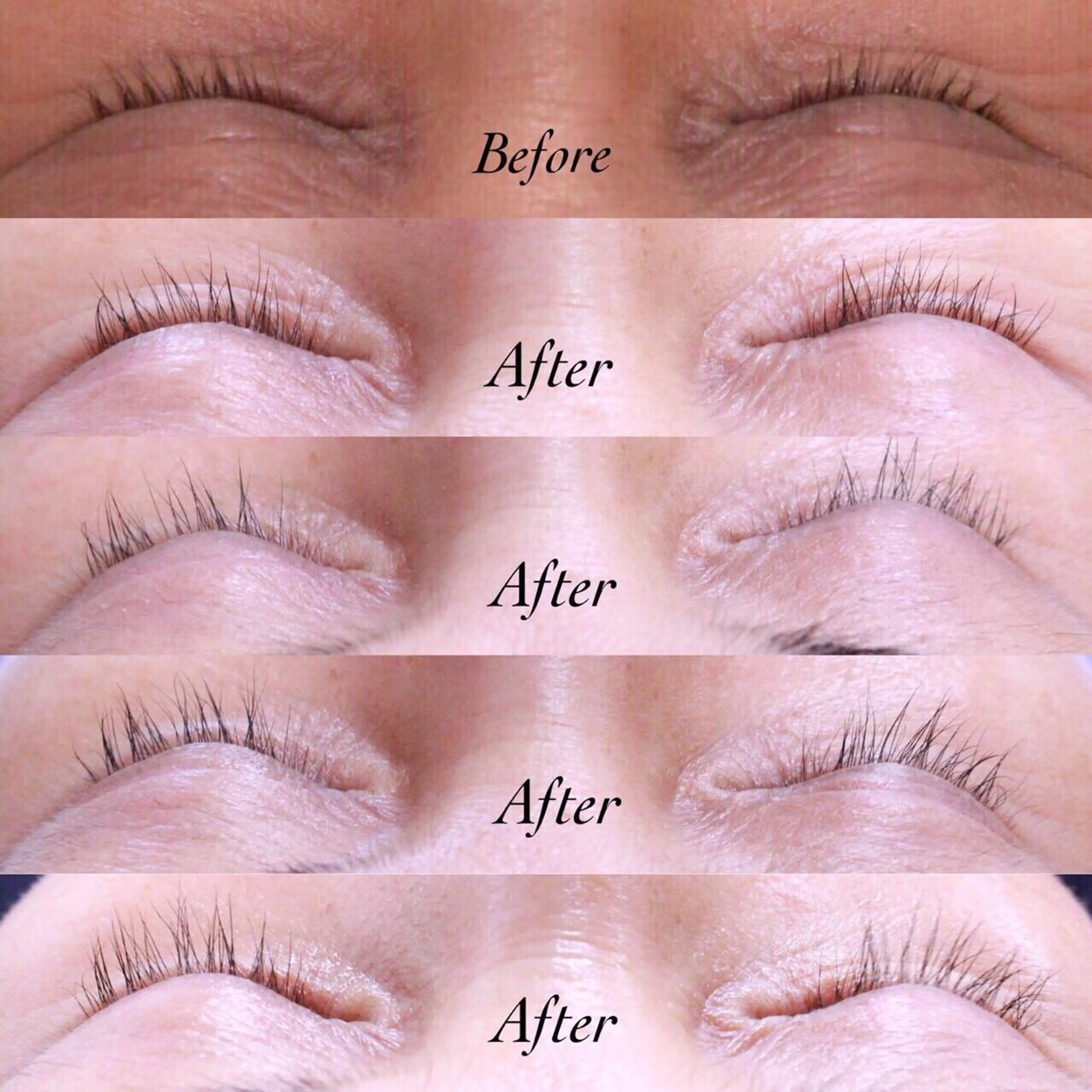 ラッシュアディクト★まつ毛育毛‼︎の写真