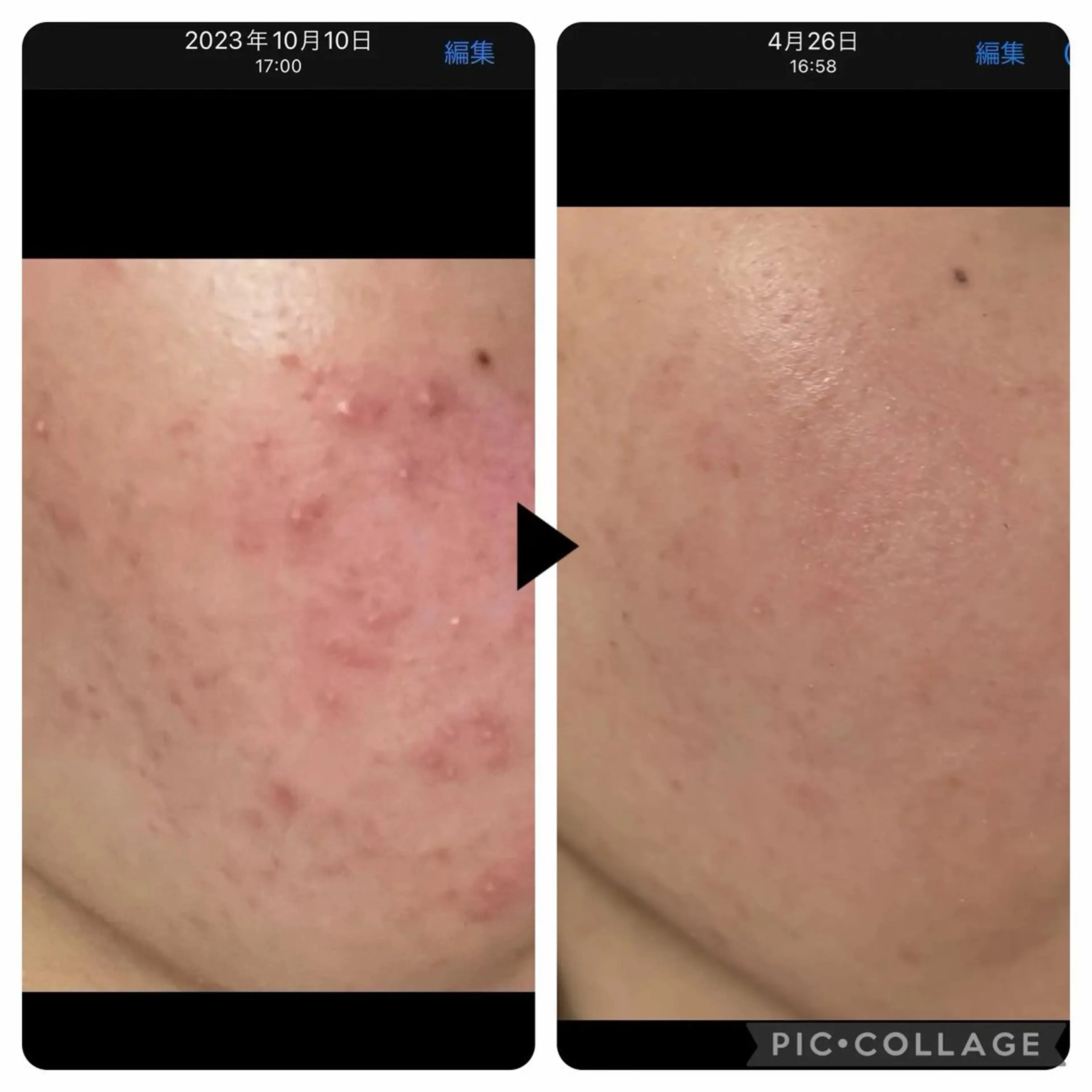 エステ 化粧品成分研究/講師 ranan三浦のエステ・リラクイメージ