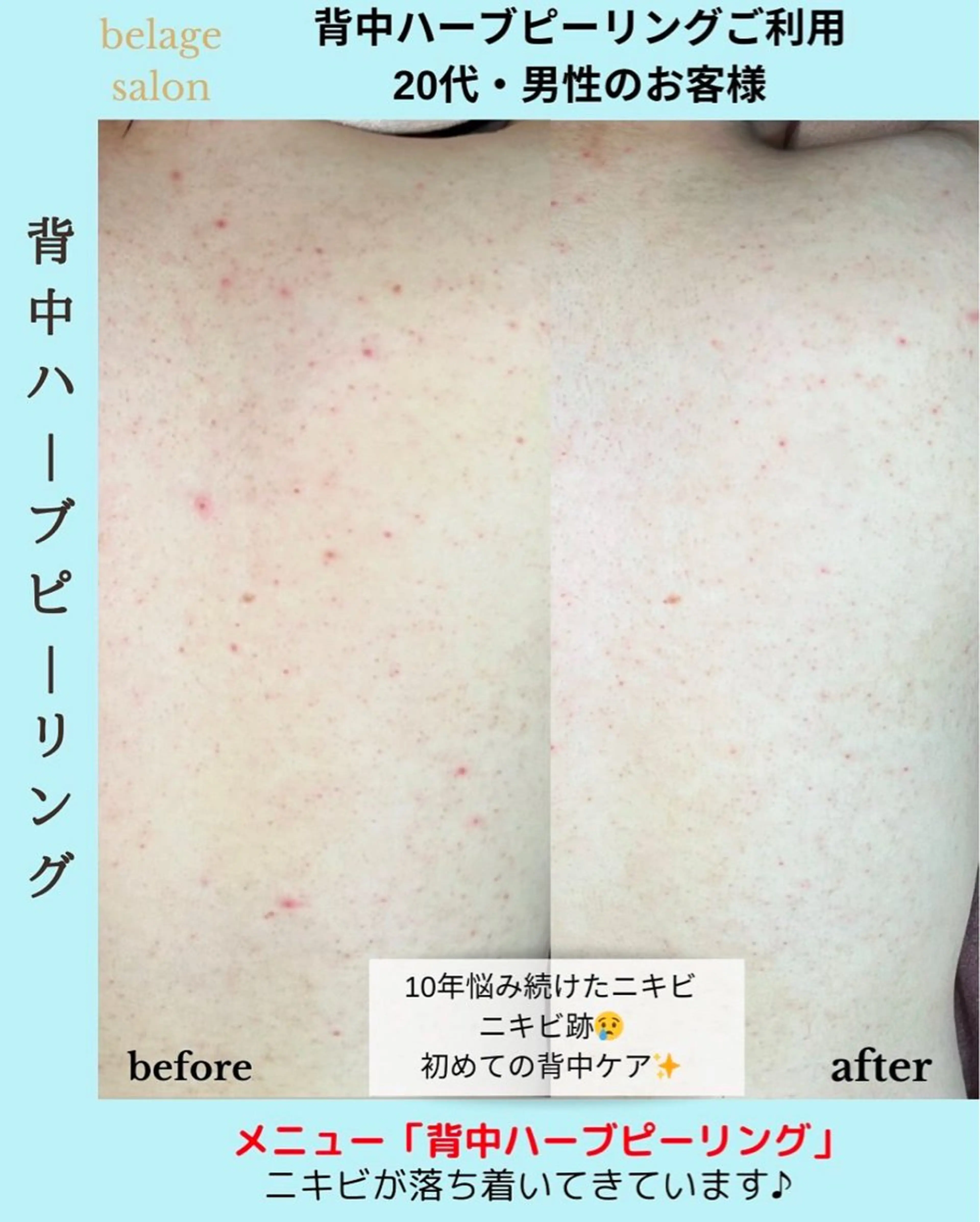 エステ ベラージュ【美背中・ 美尻・フェイシャル】のエステ・リラクイメージ