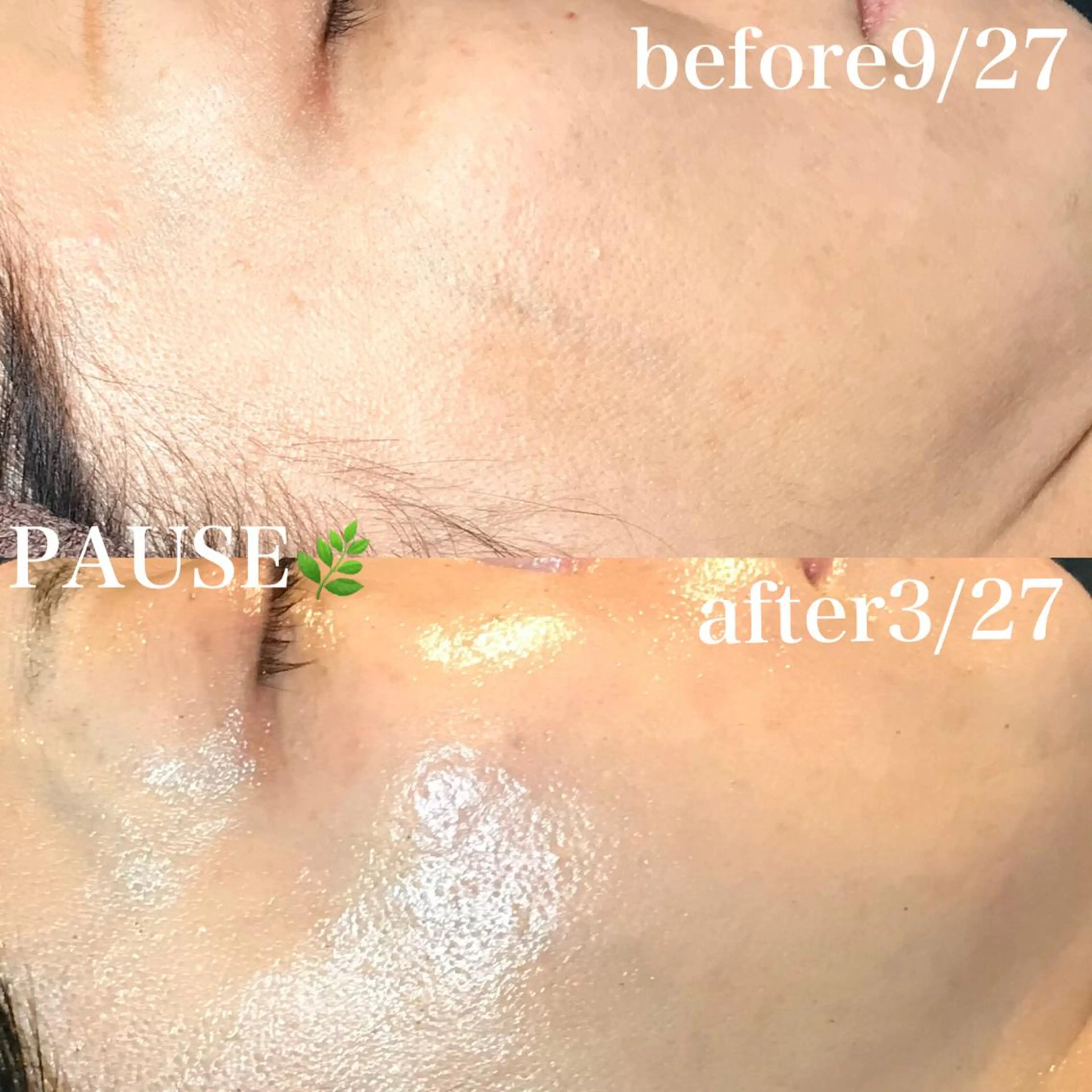 エステ 浜野 恵美のエステ・リラクイメージ