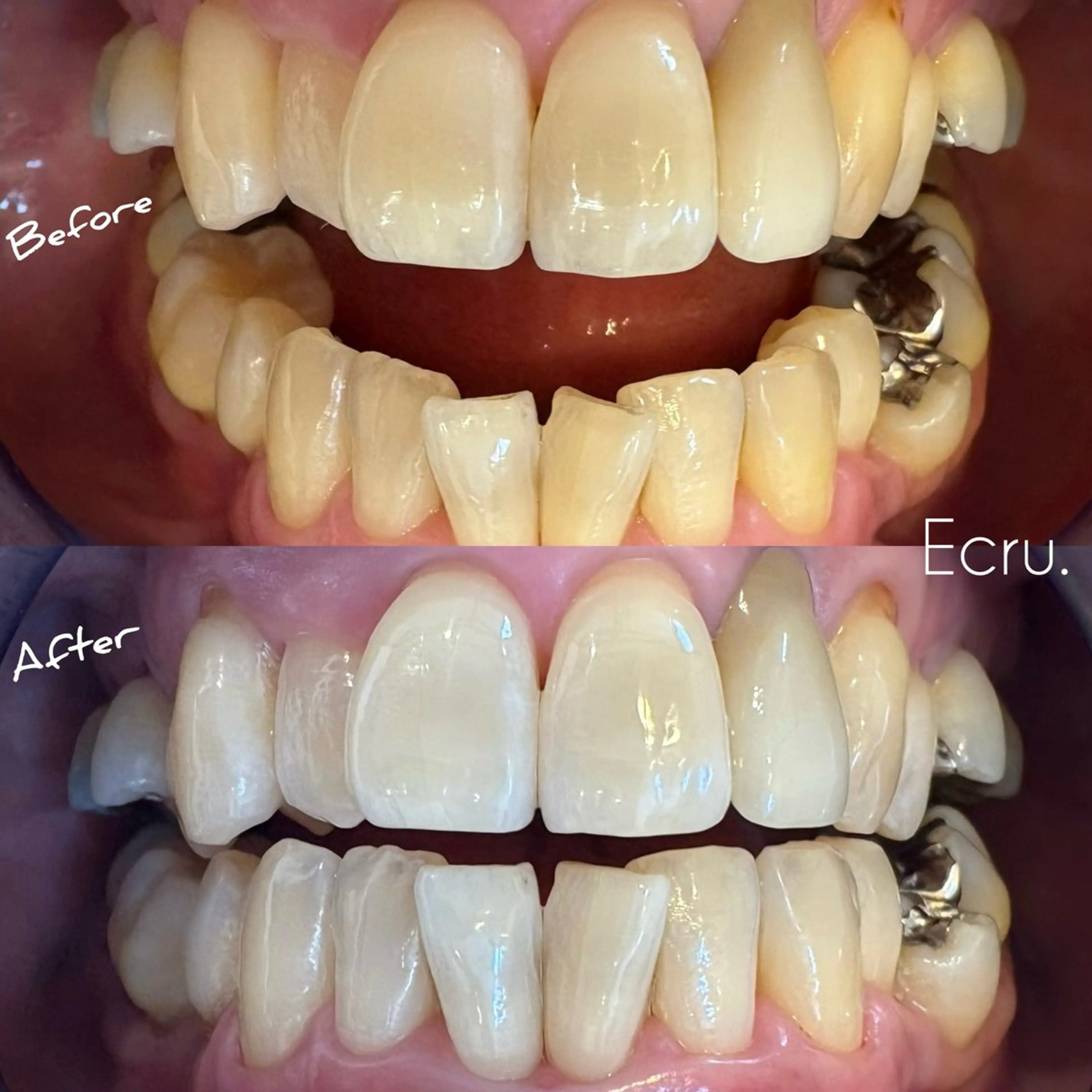 メンズ キッズ ホワイトニングサロン Ecru エクリュのその他イメージ